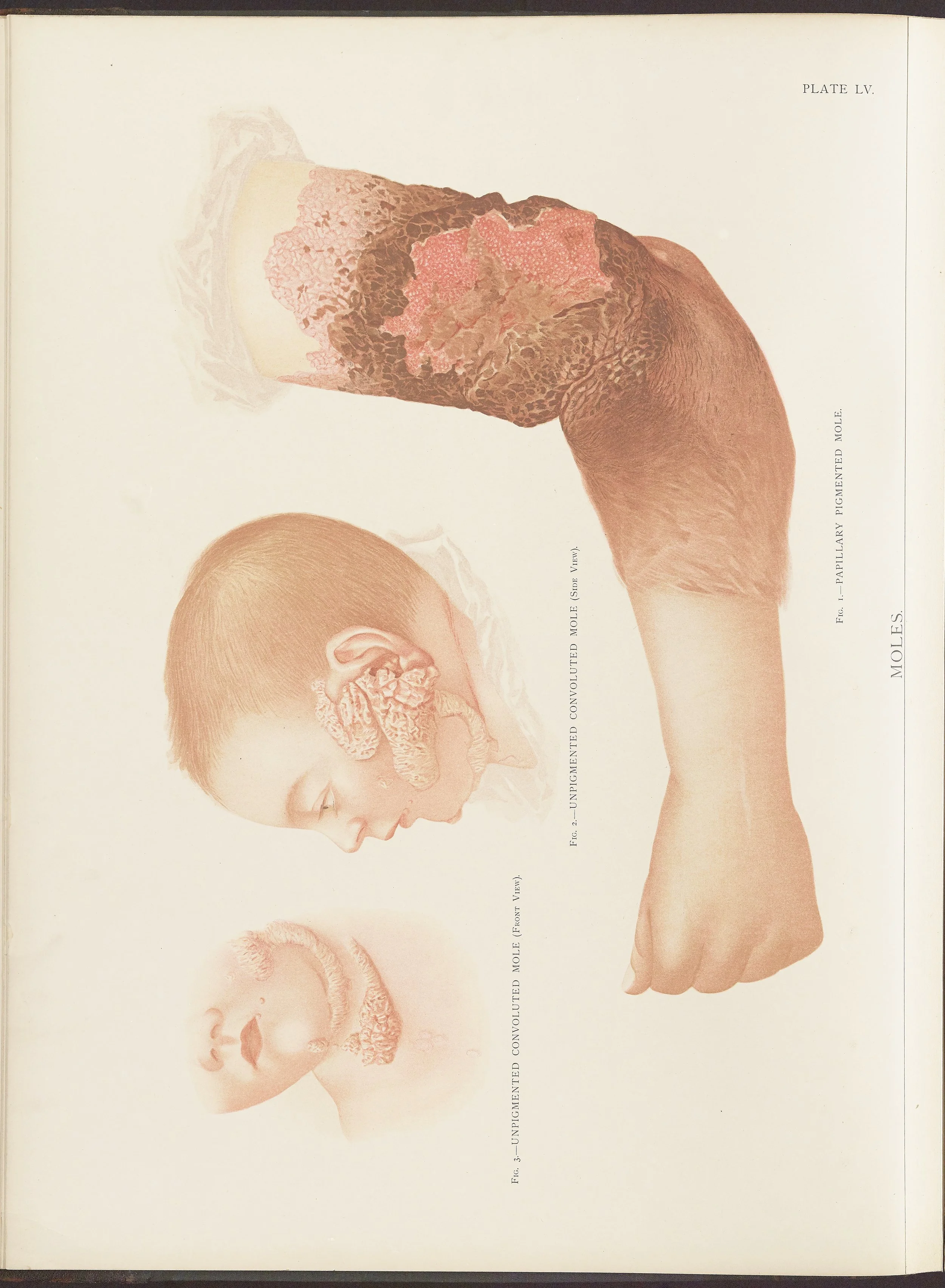 RM0164(Vol.ii)_26.jpg