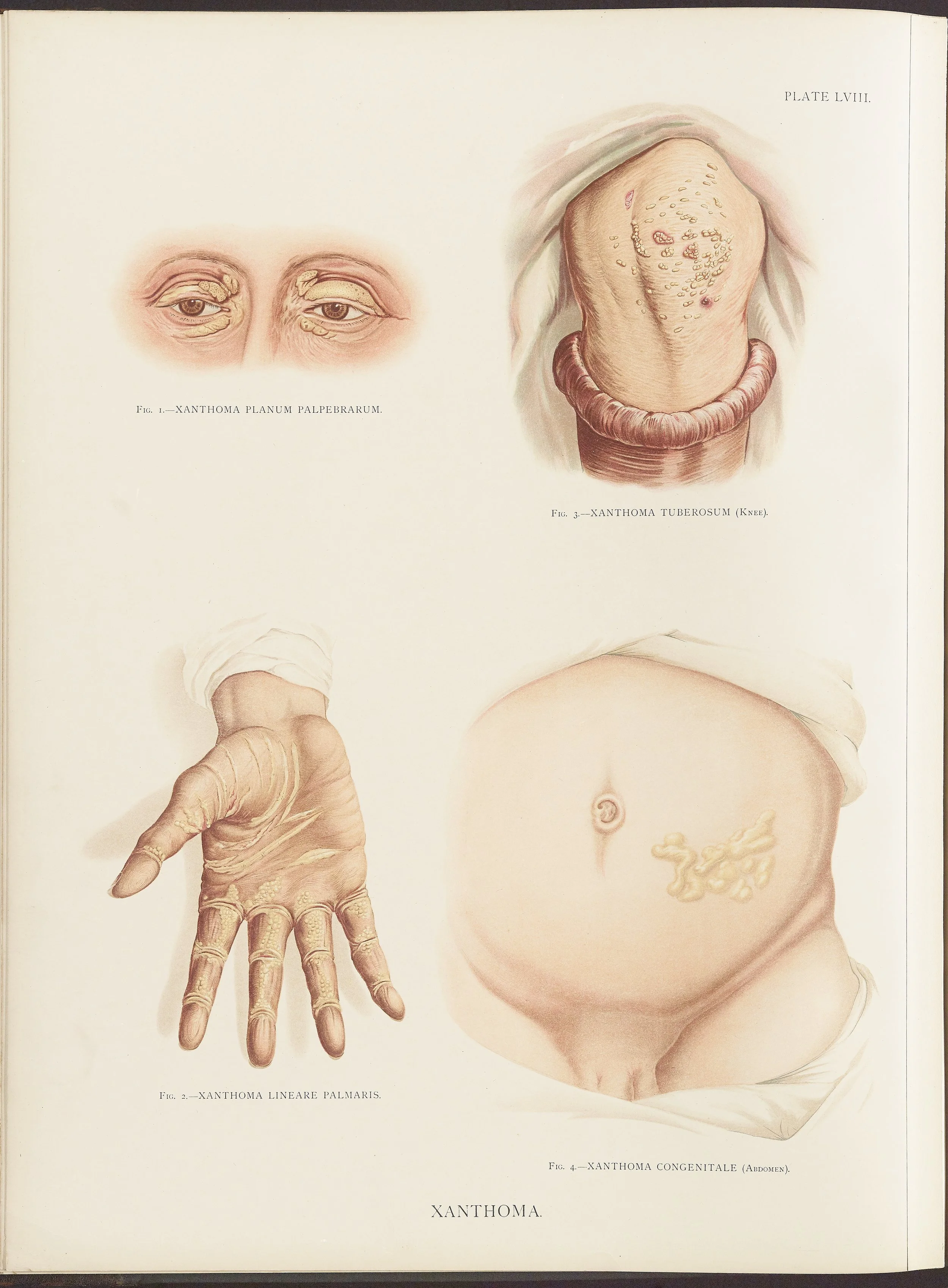 RM0164(Vol.ii)_34.jpg