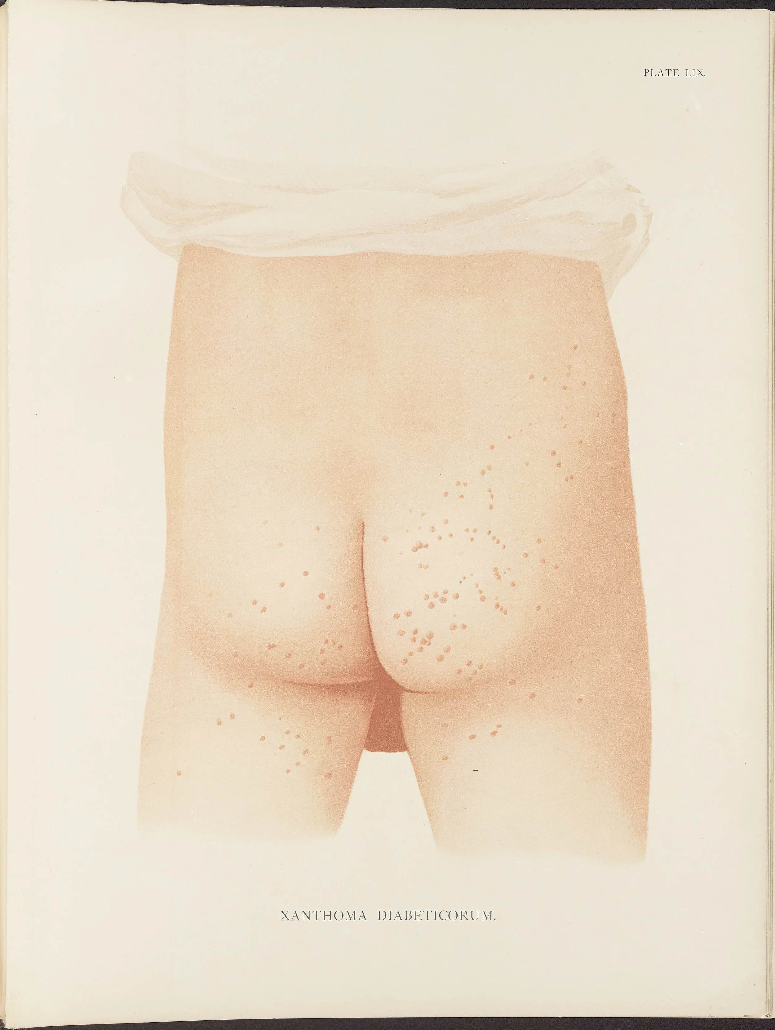 RM0164(Vol.ii)_39.jpg
