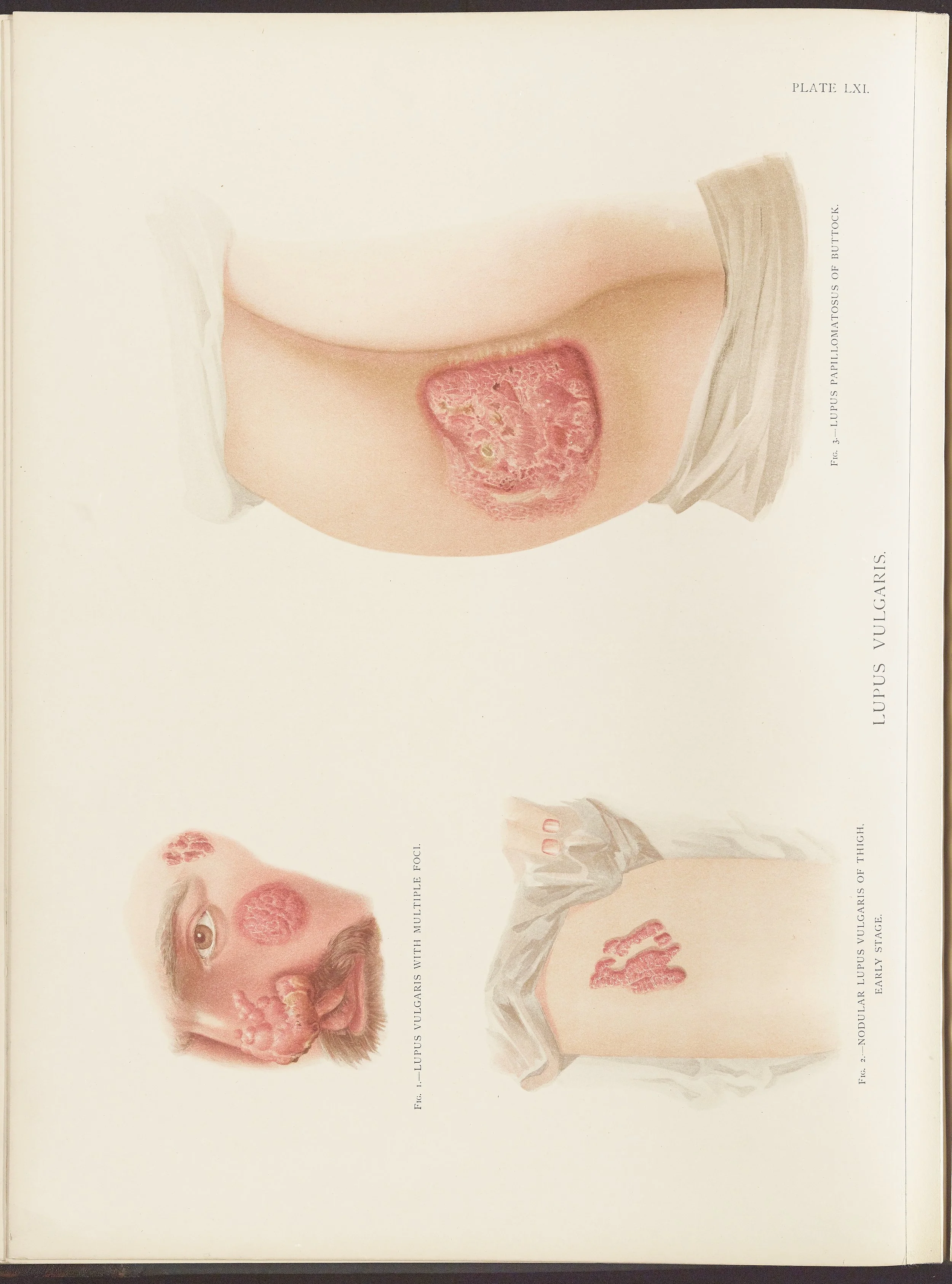 RM0164(Vol.ii)_44.jpg