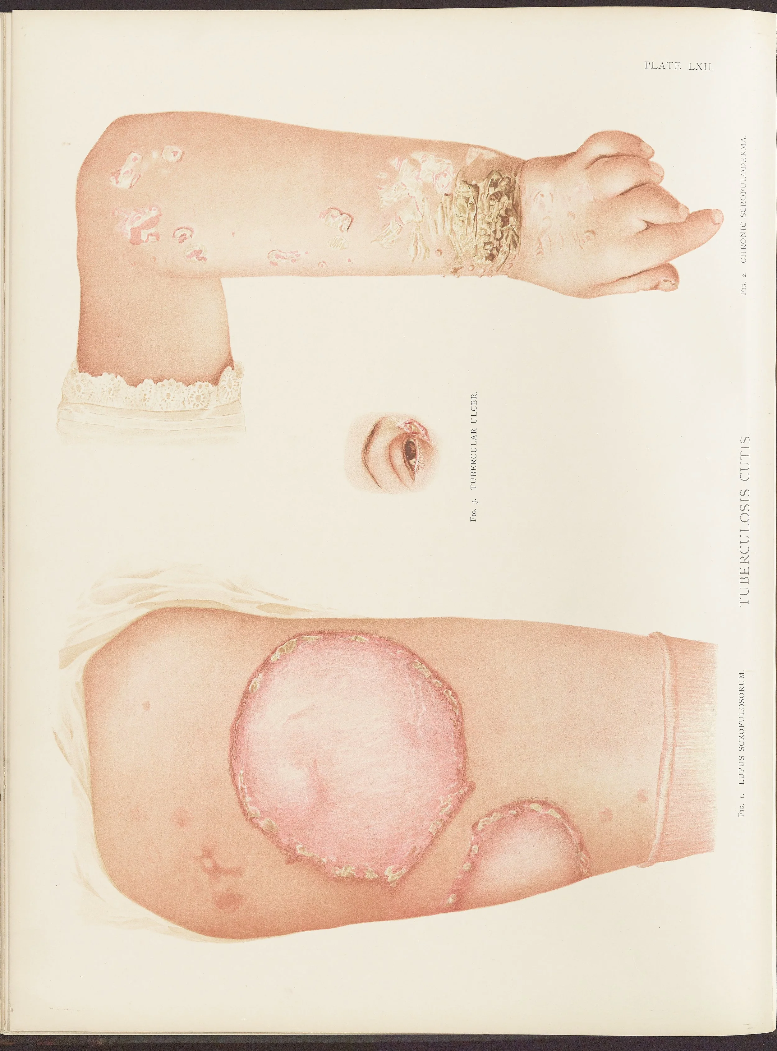 RM0164(Vol.ii)_48.jpg