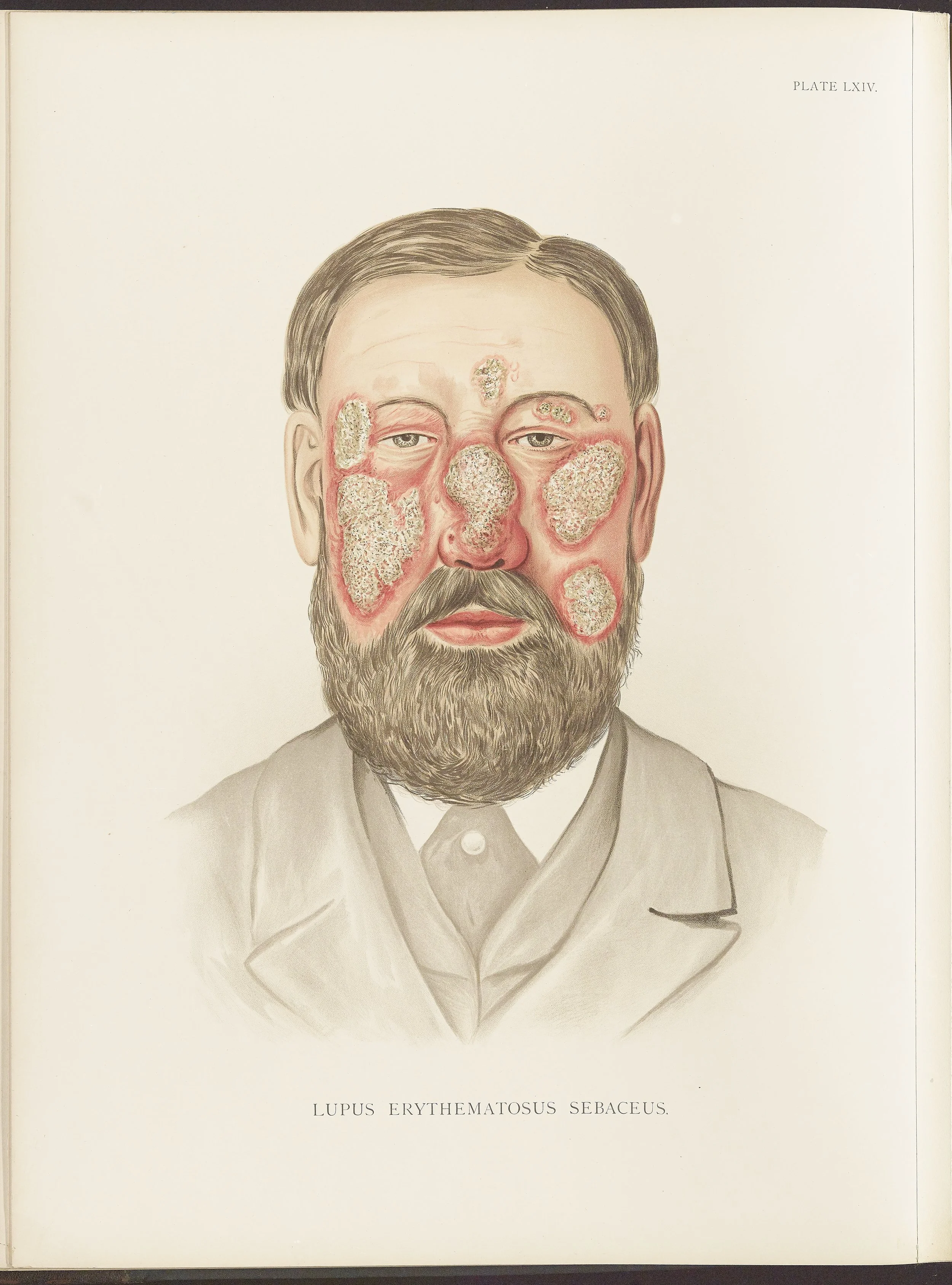 RM0164(Vol.ii)_52.jpg