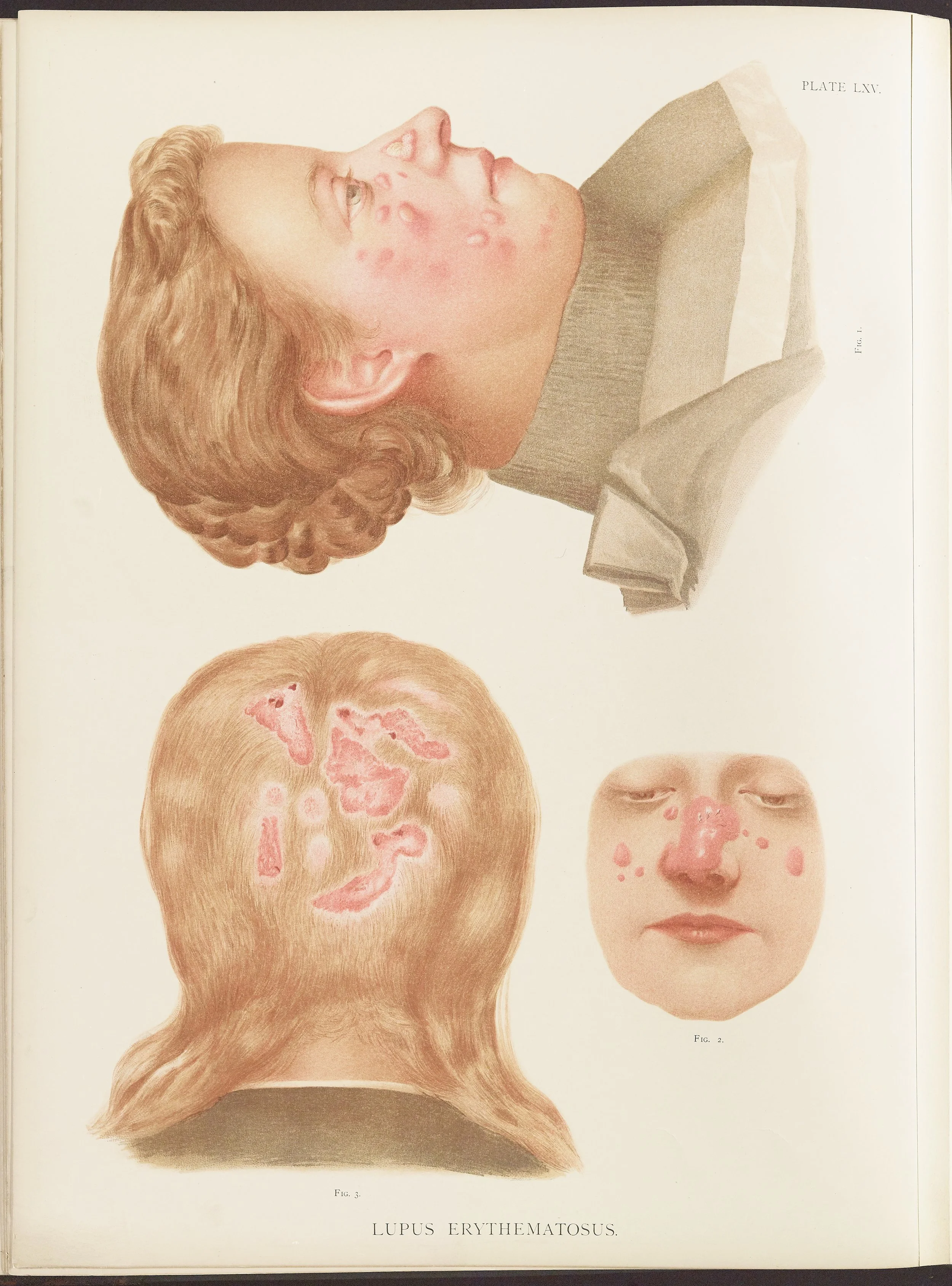 RM0164(Vol.ii)_56.jpg