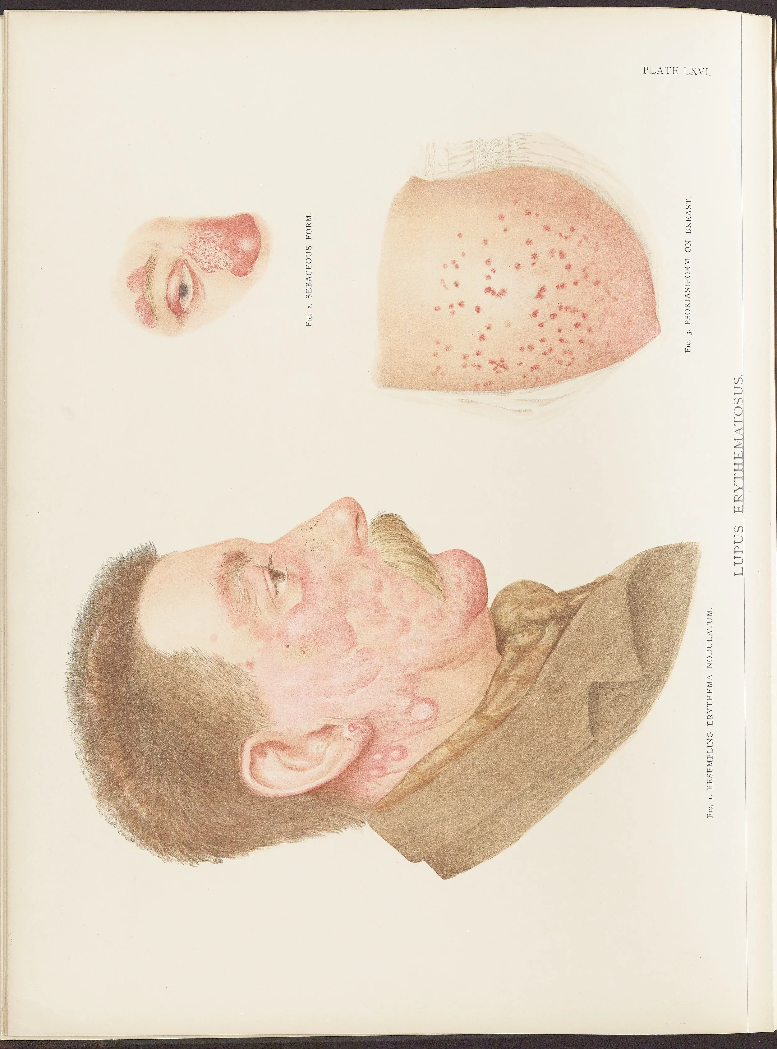 RM0164(Vol.ii)_58.jpg