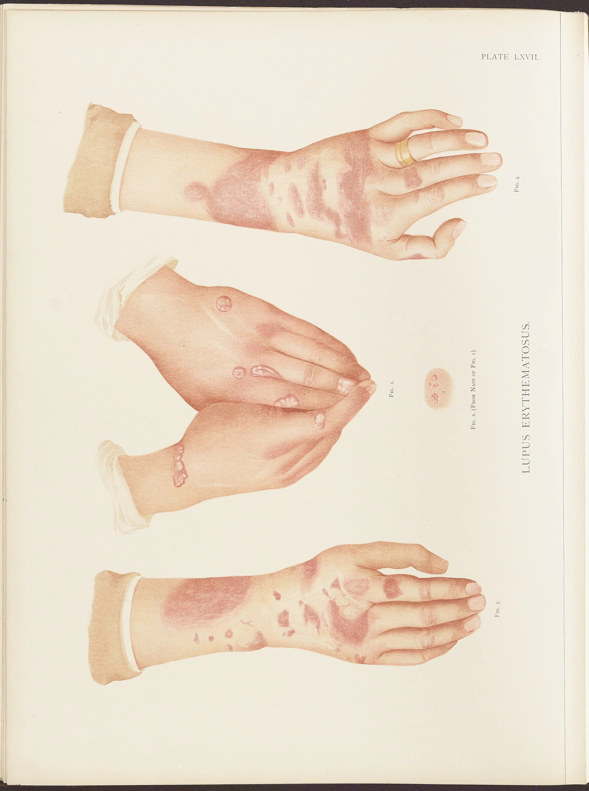 RM0164(Vol.ii)_60.jpg