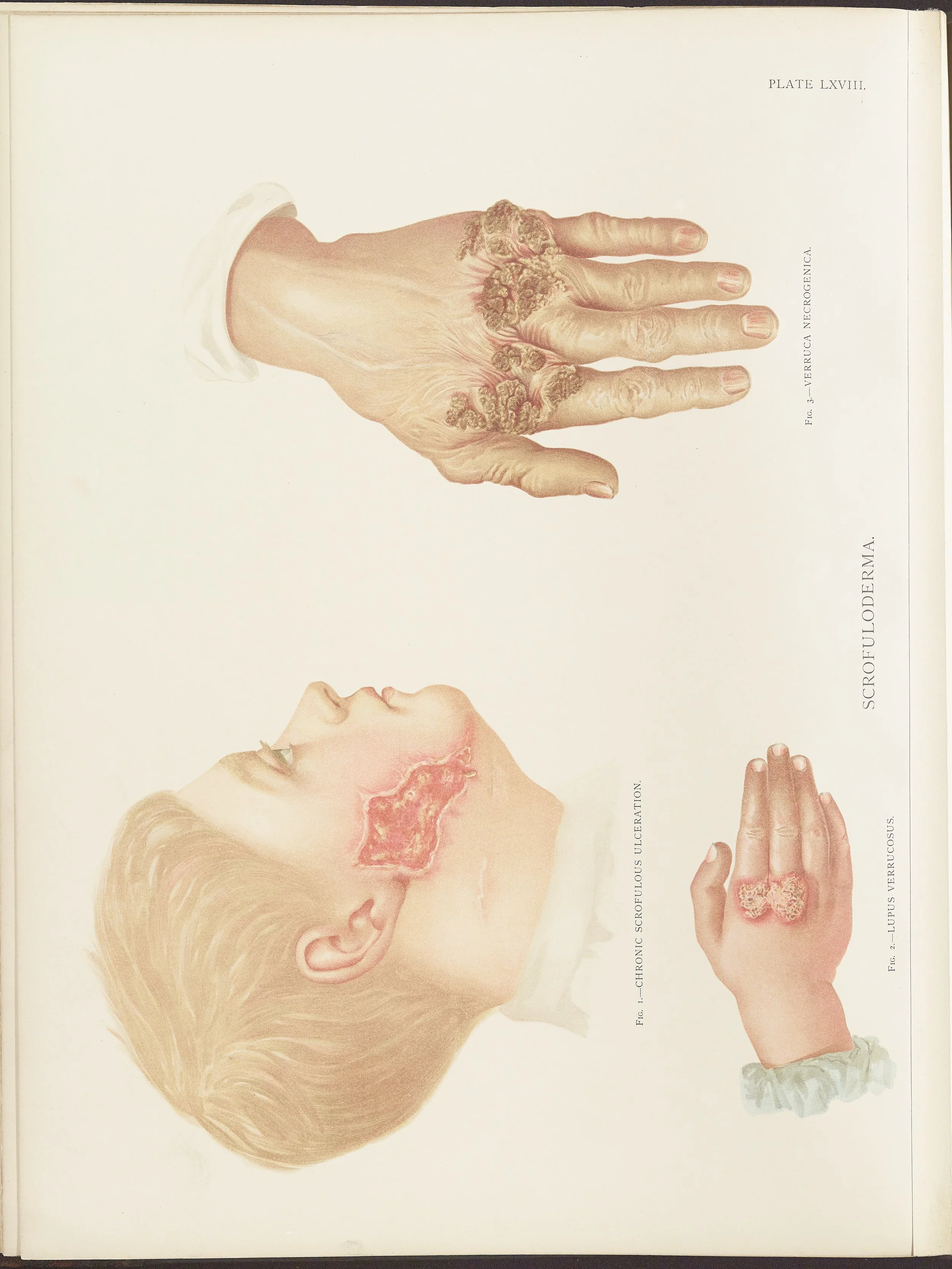 RM0164(Vol.ii)_64.jpg
