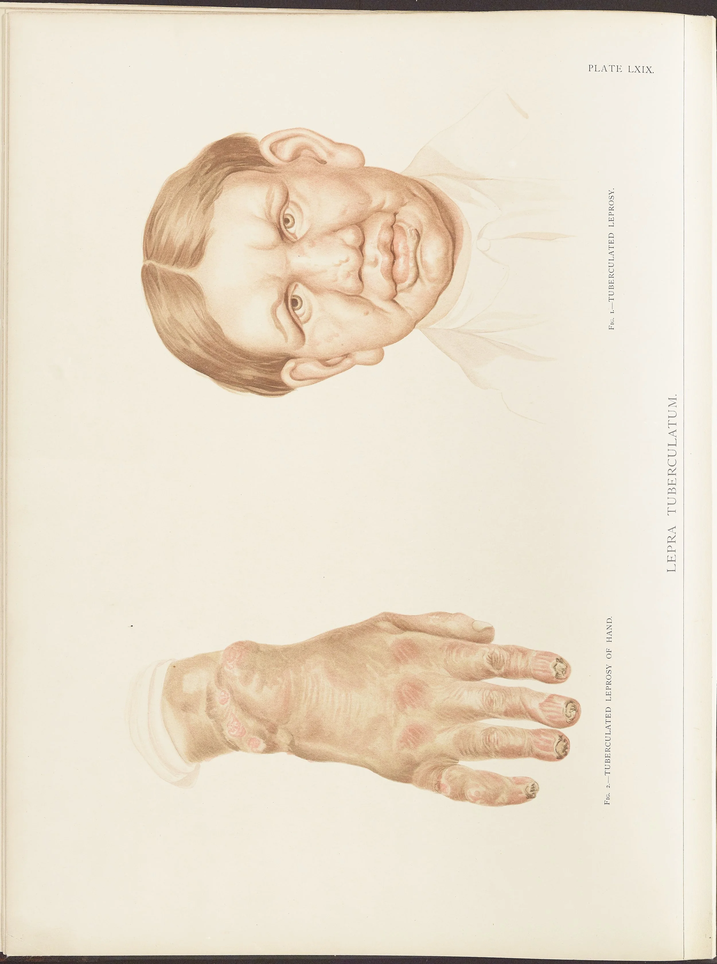 RM0164(Vol.ii)_68.jpg