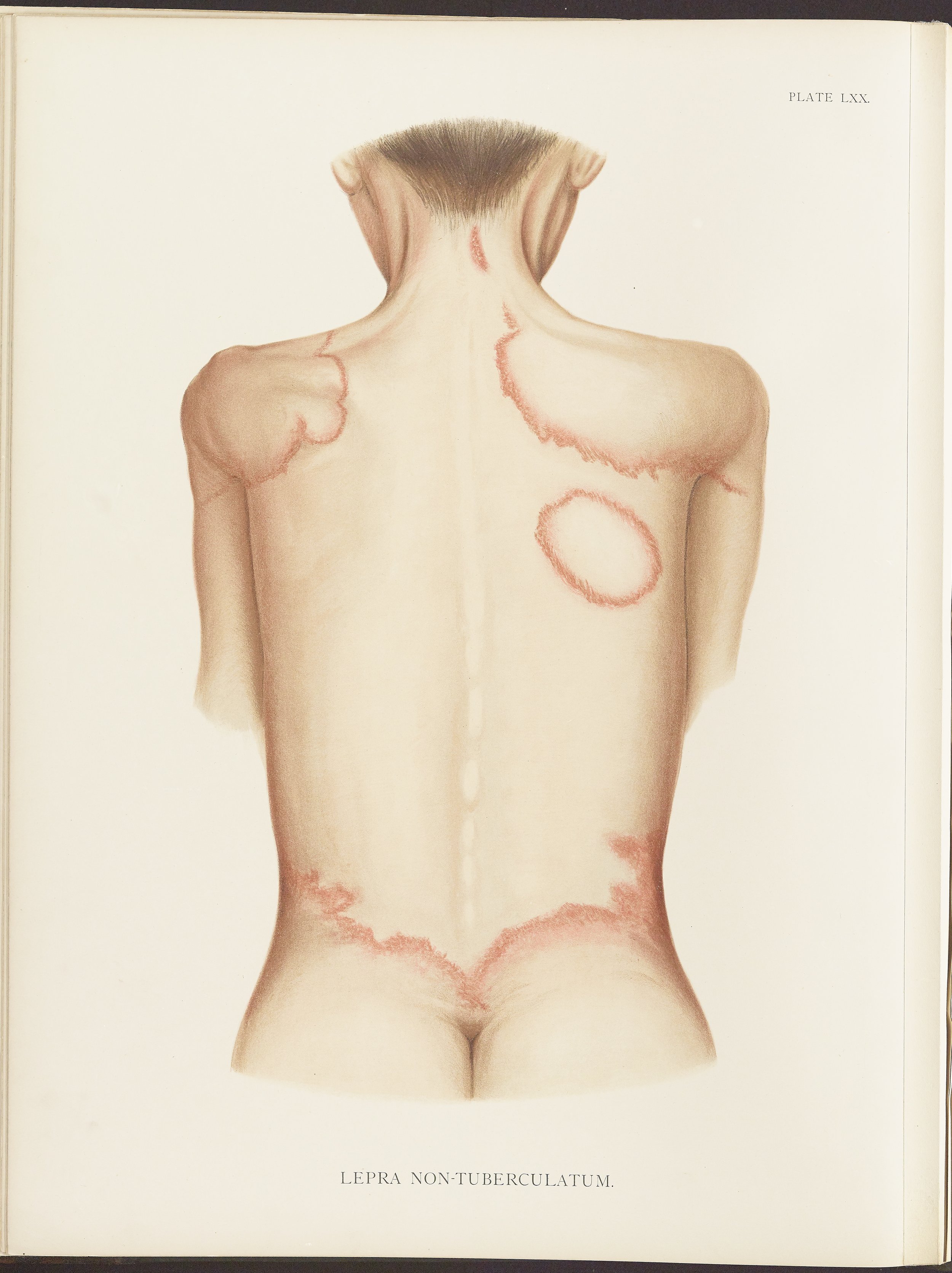 RM0164(Vol.ii)_72.jpg