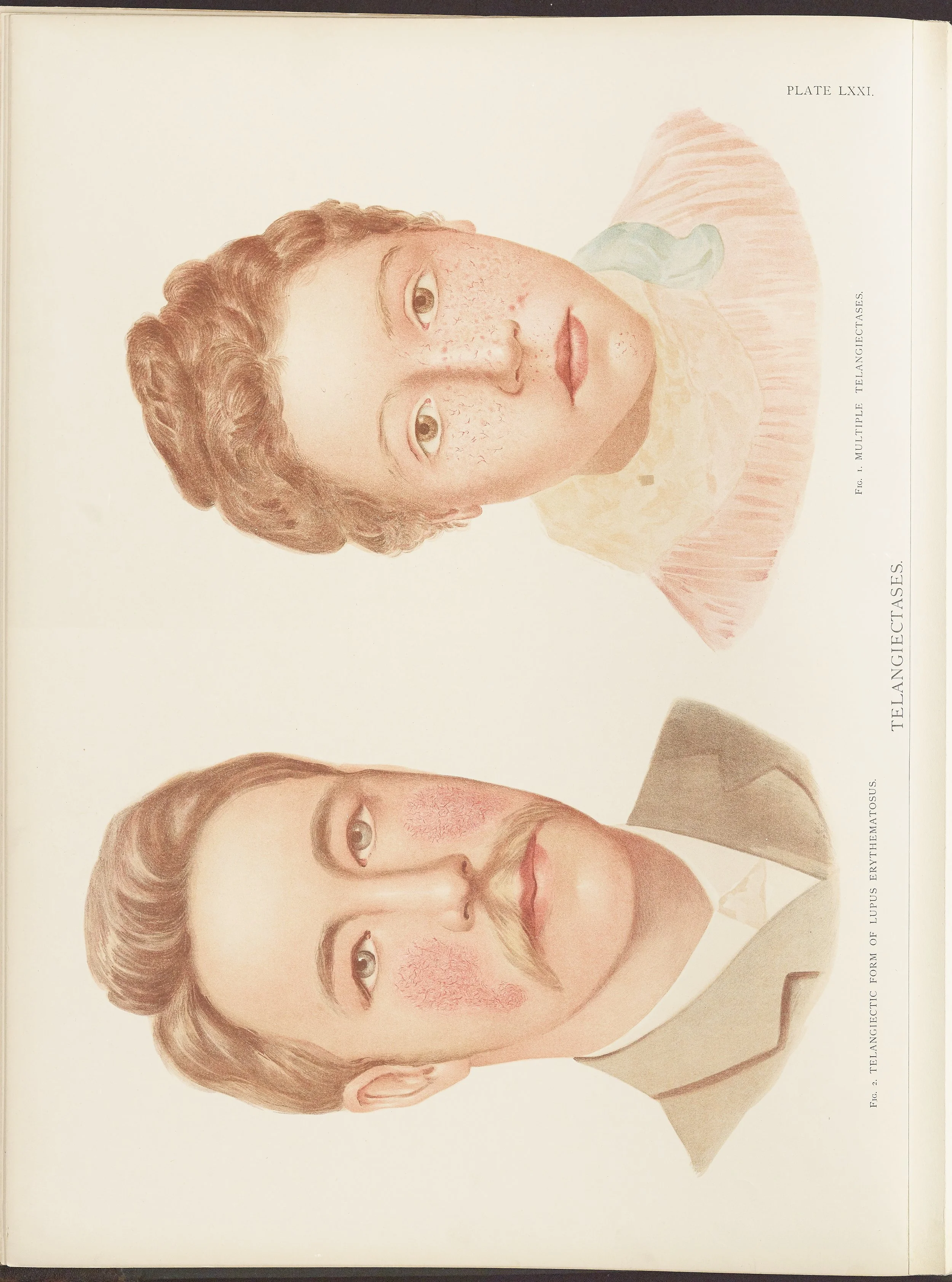RM0164(Vol.ii)_76.jpg