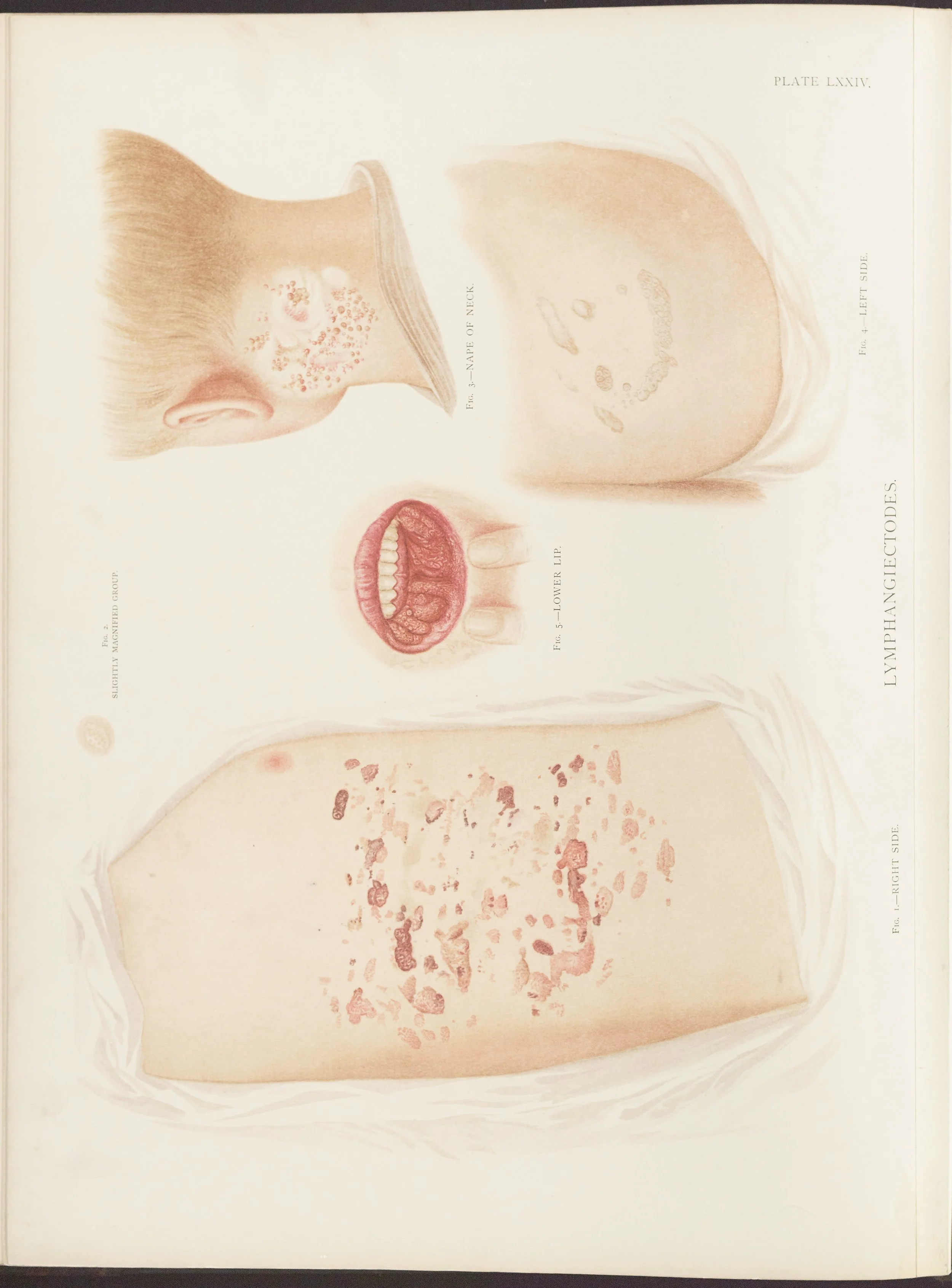 RM0164(Vol.ii)_84.jpg