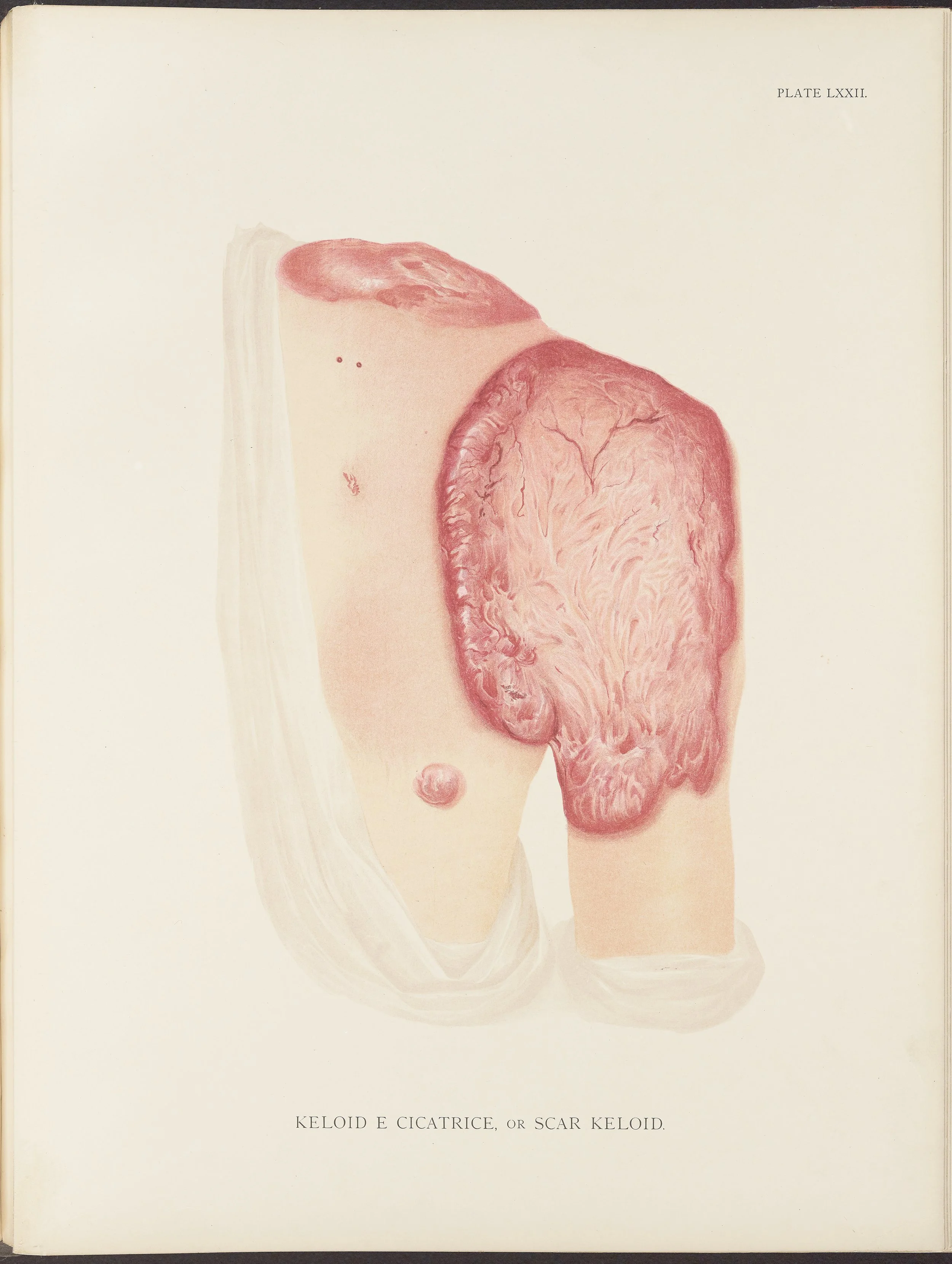 RM0164(Vol.ii)_79.jpg