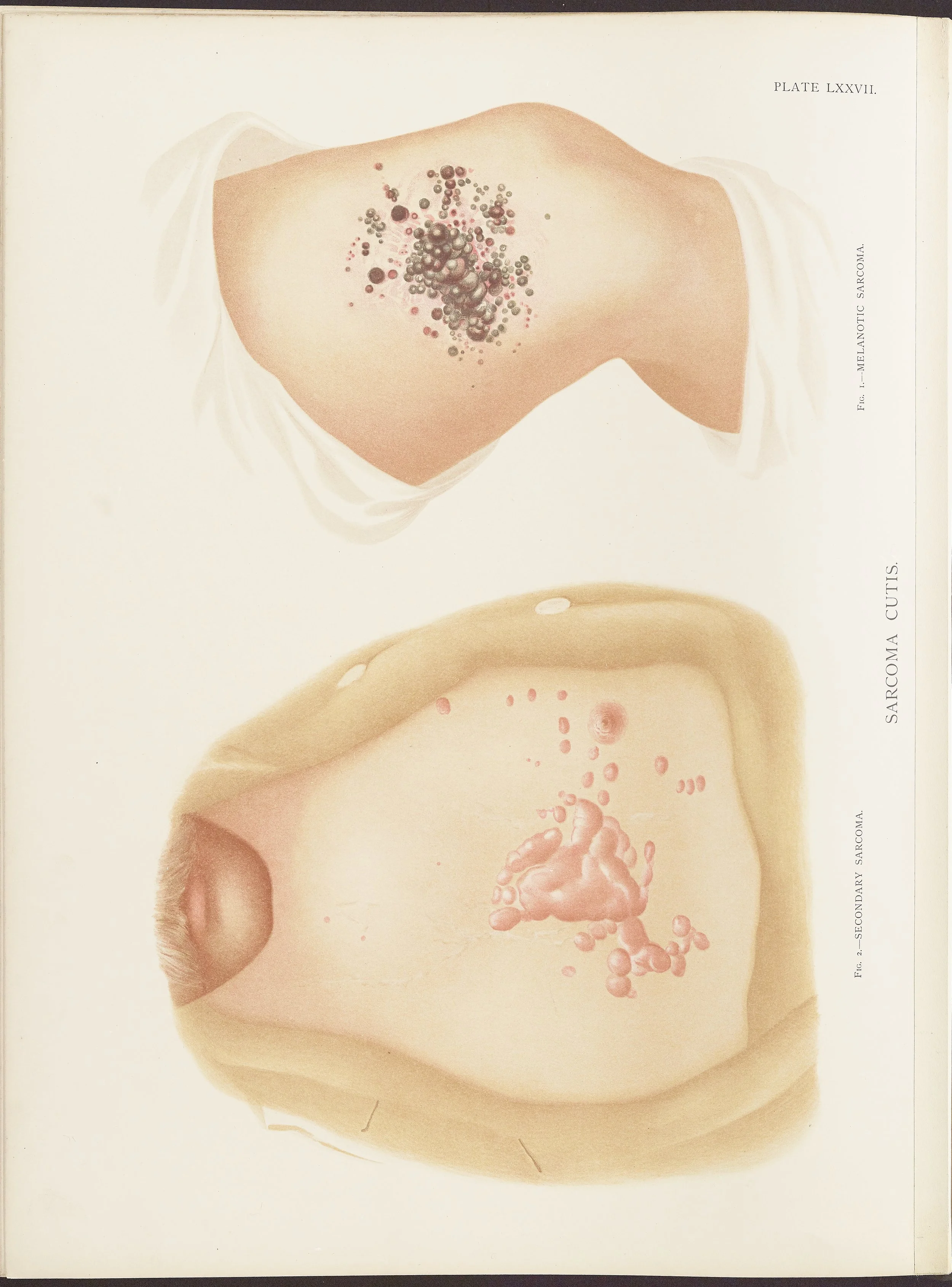 RM0164(Vol.ii)_96.jpg