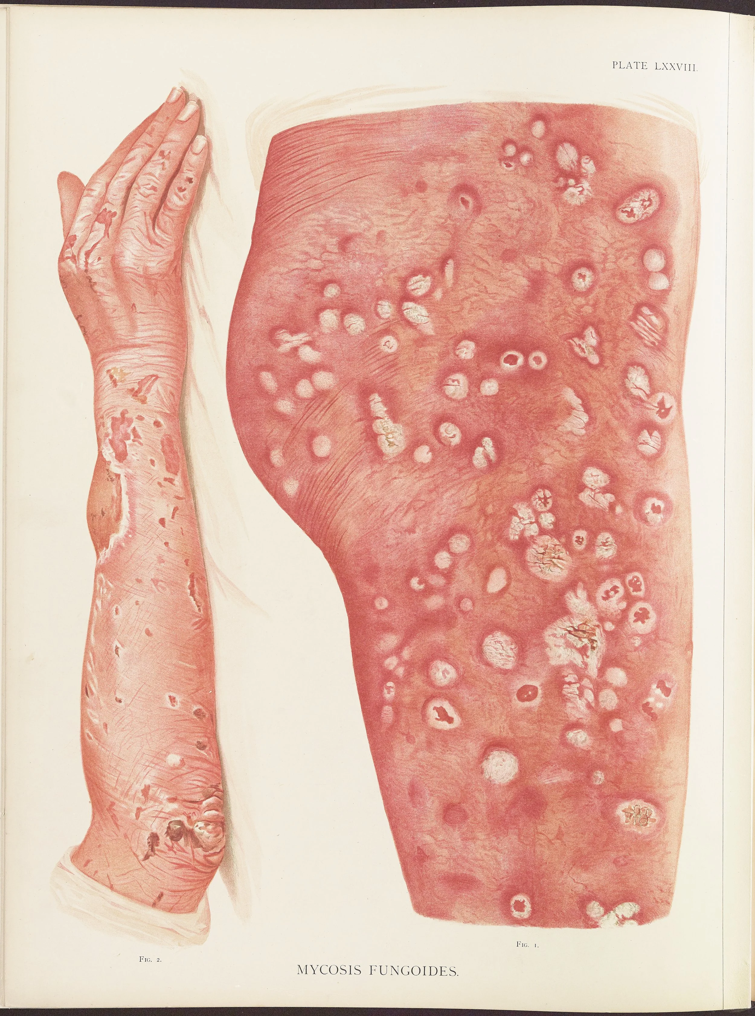 RM0164(Vol.ii)_98.jpg
