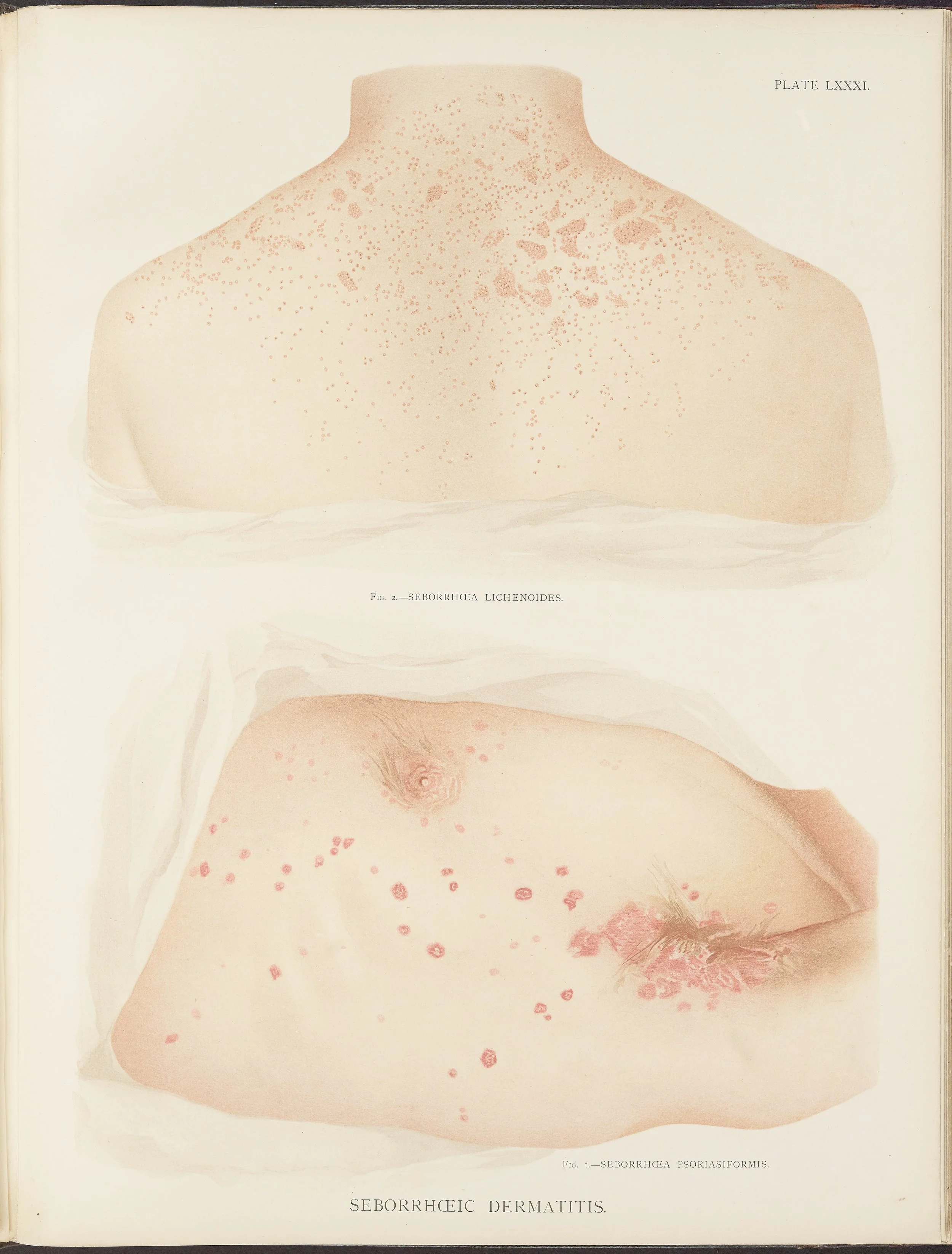 RM0164(Vol.ii)_111.jpg