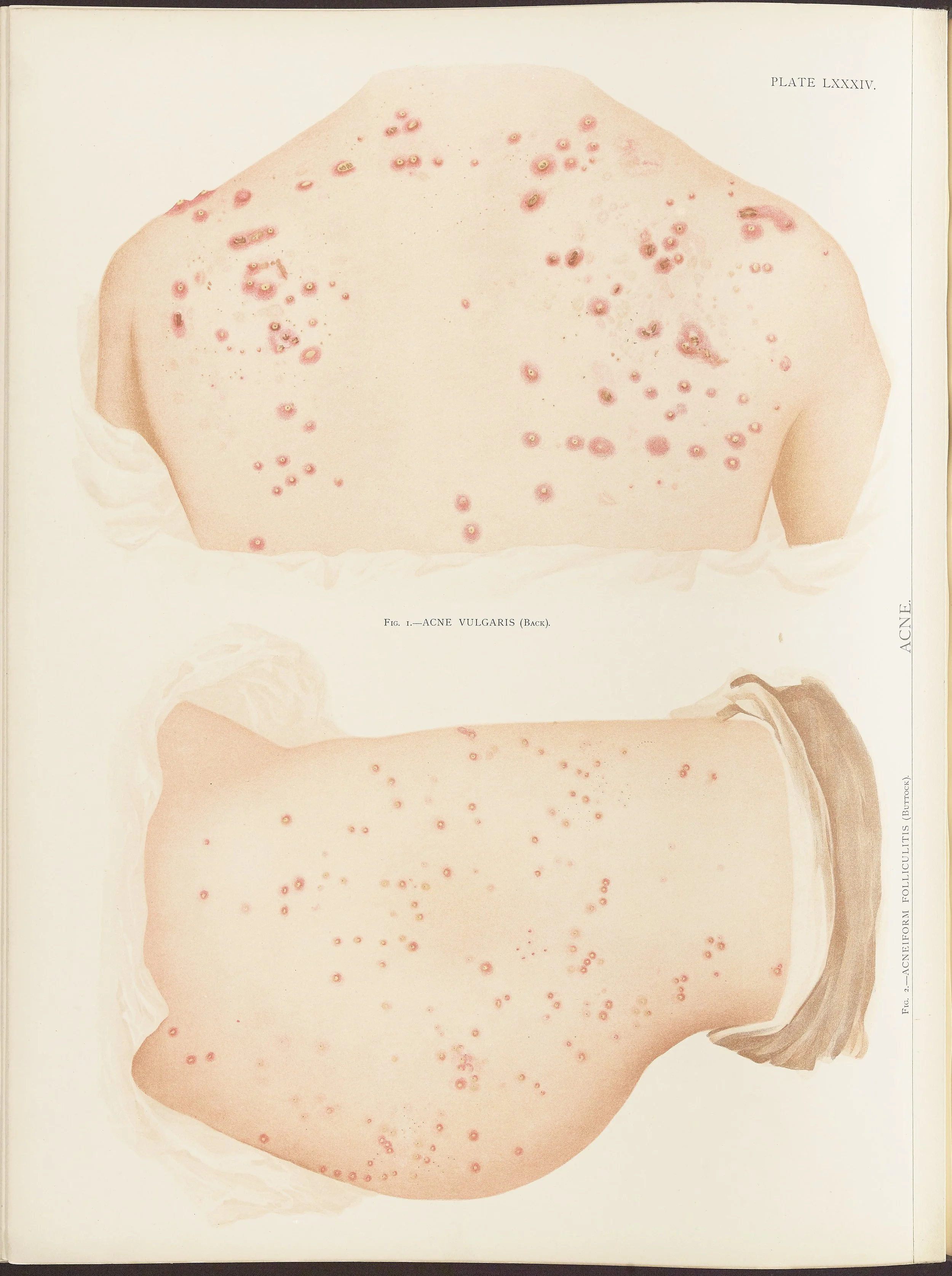 RM0164(Vol.ii)_116.jpg