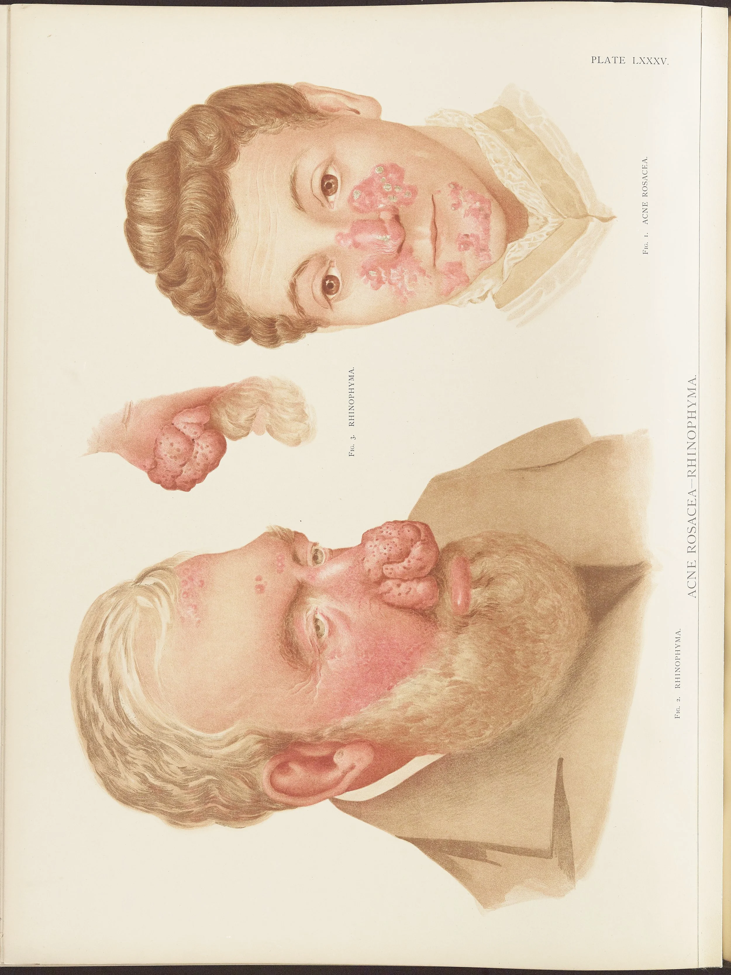 RM0164(Vol.ii)_120.jpg