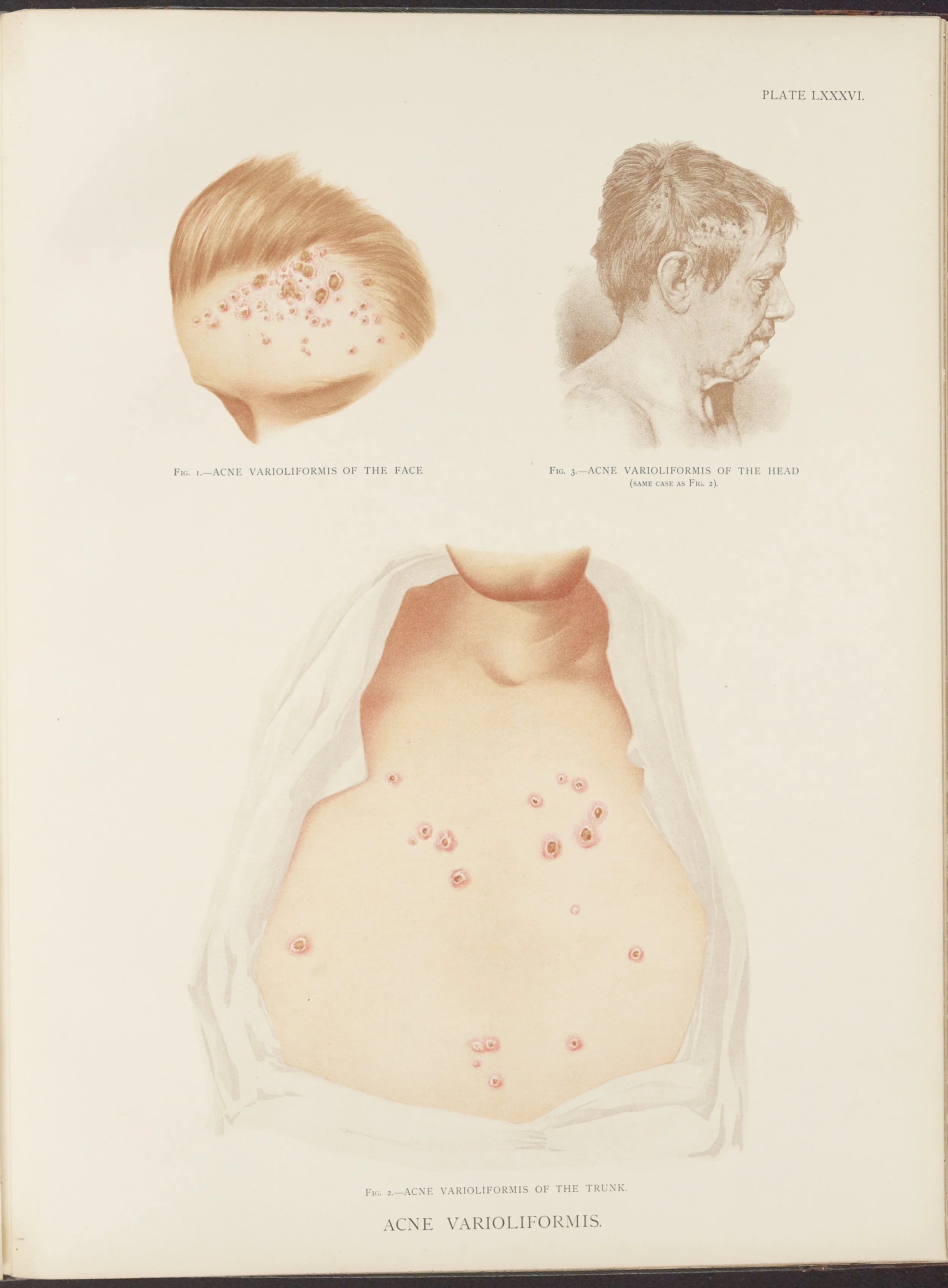 RM0164(Vol.ii)_123.jpg