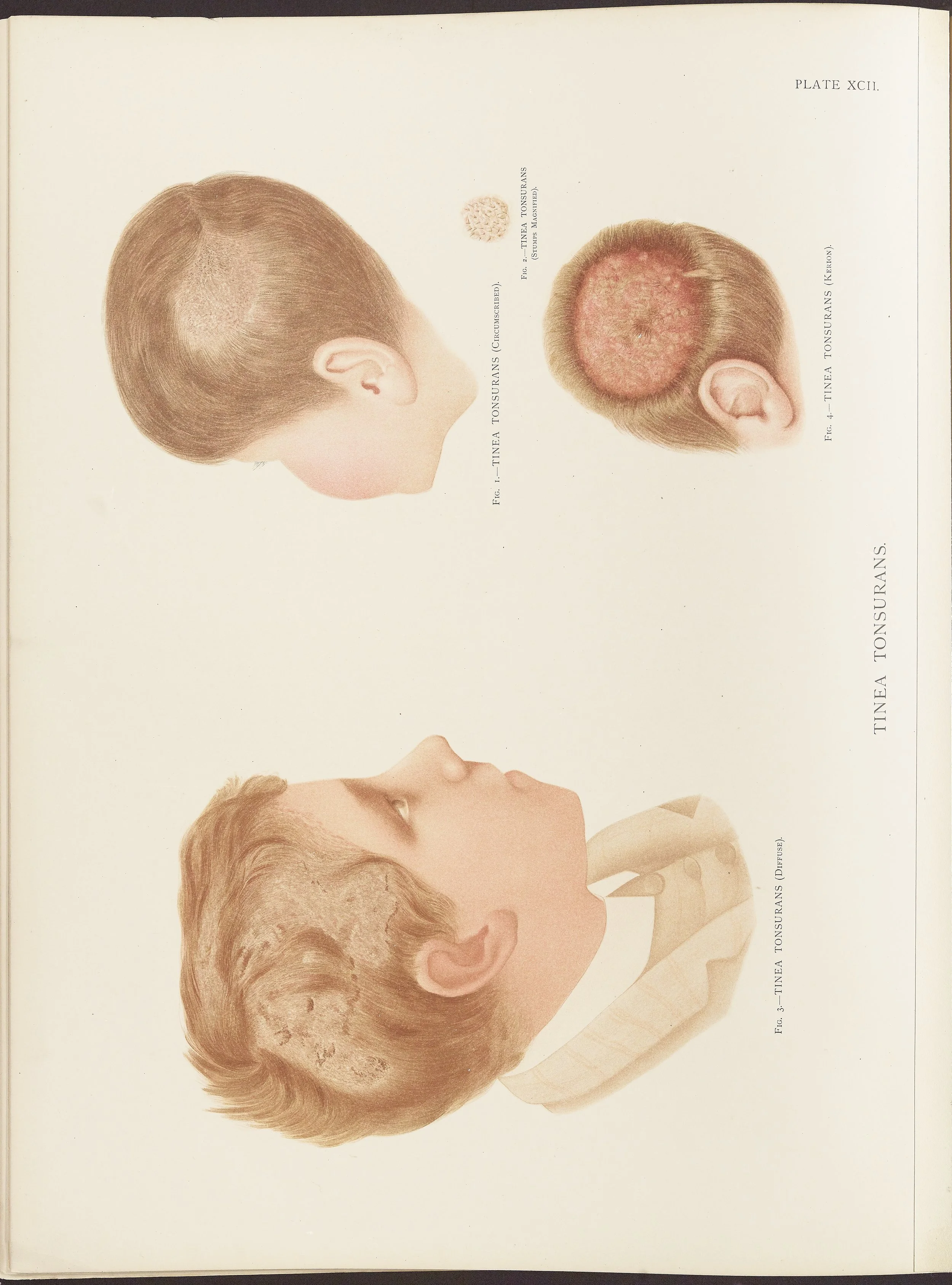 RM0164(Vol.ii)_142.jpg
