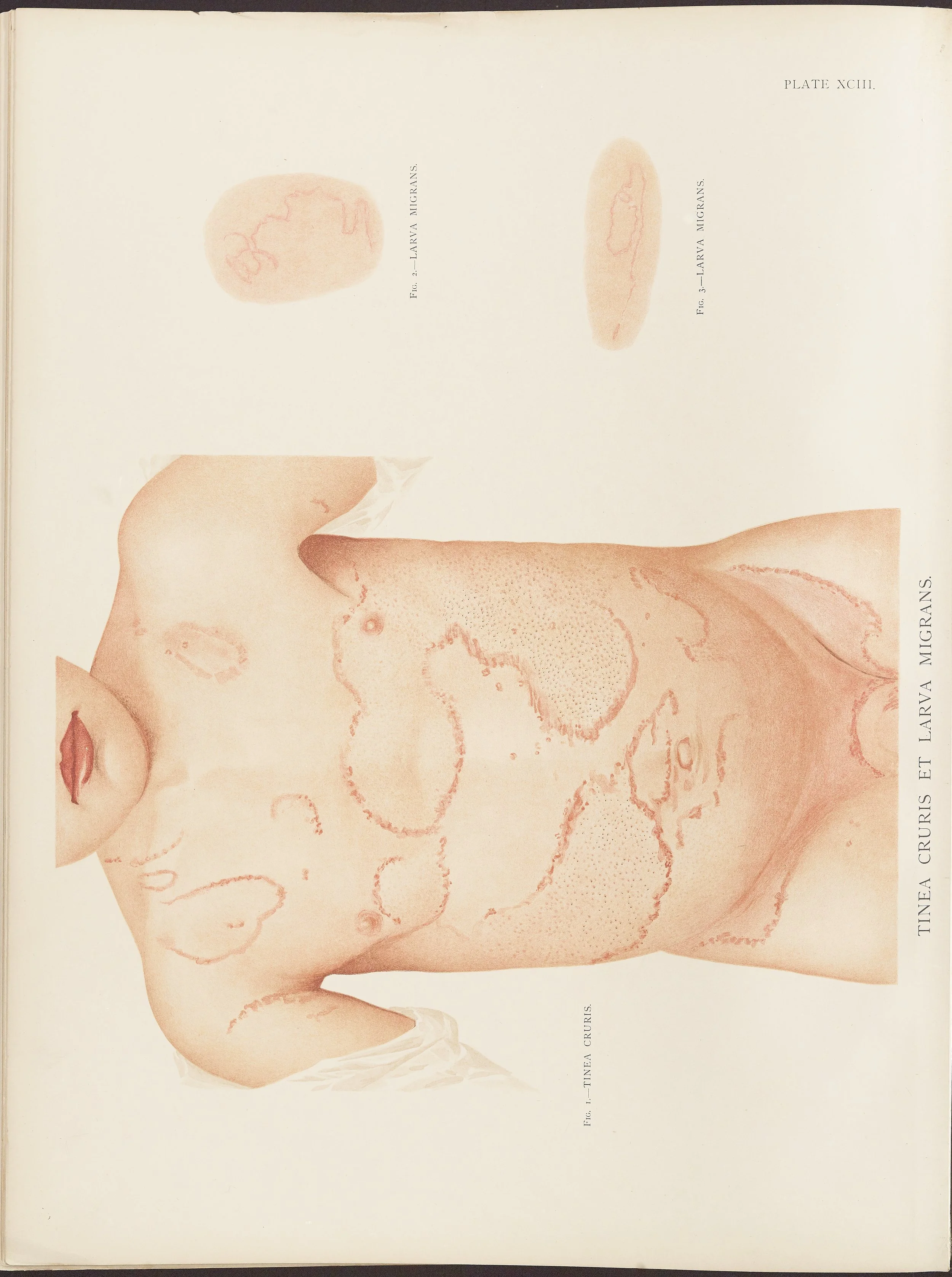 RM0164(Vol.ii)_144.jpg