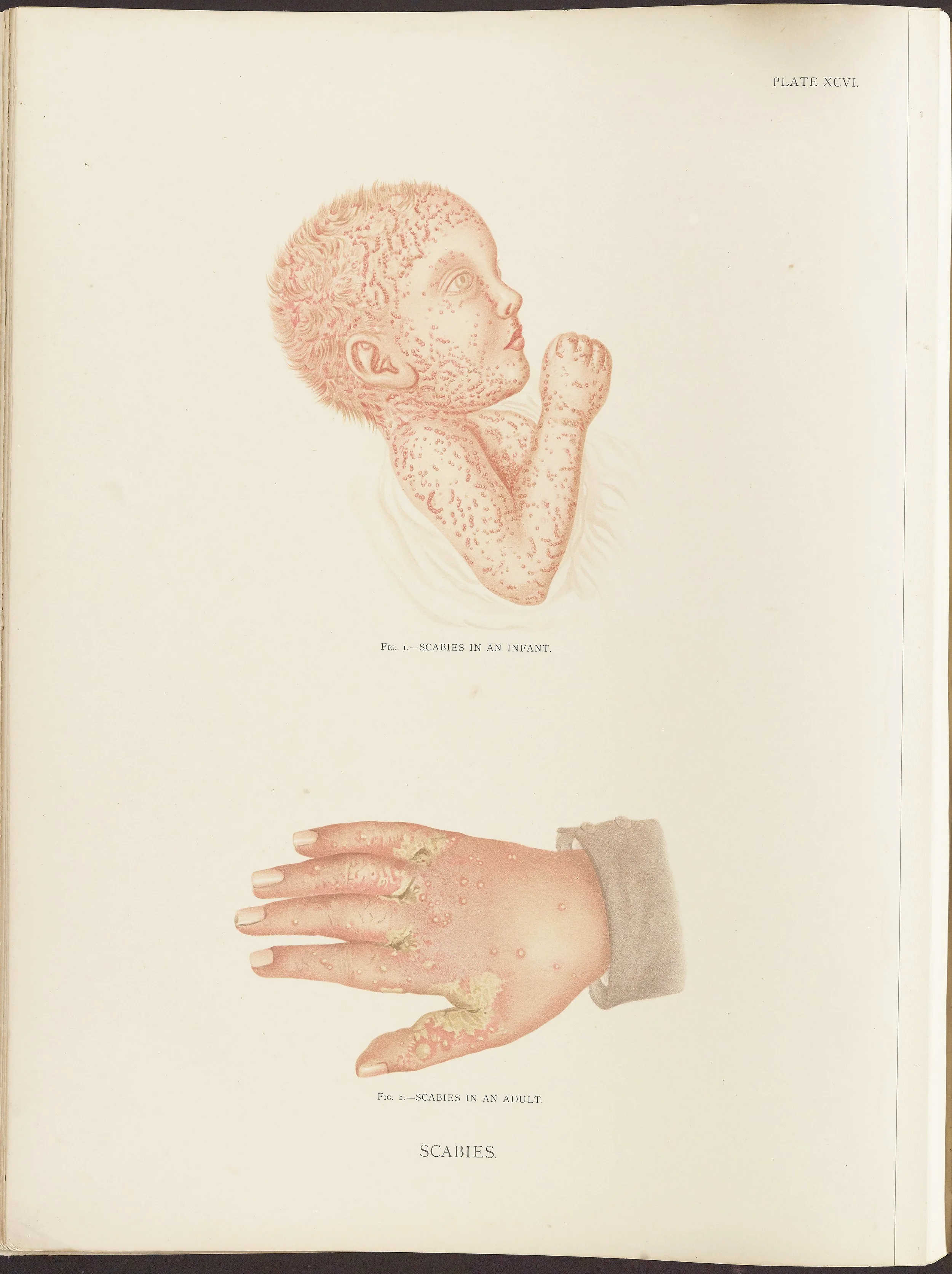 RM0164(Vol.ii)_152.jpg