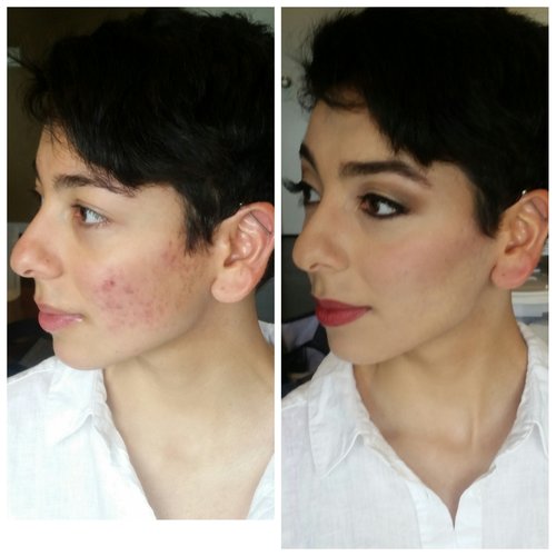 Acne+Covering+Bridal+Makeup+with+Airbrush+Luminous+Beauty+Makeup+Artist+Brooklyn+Park.jpg