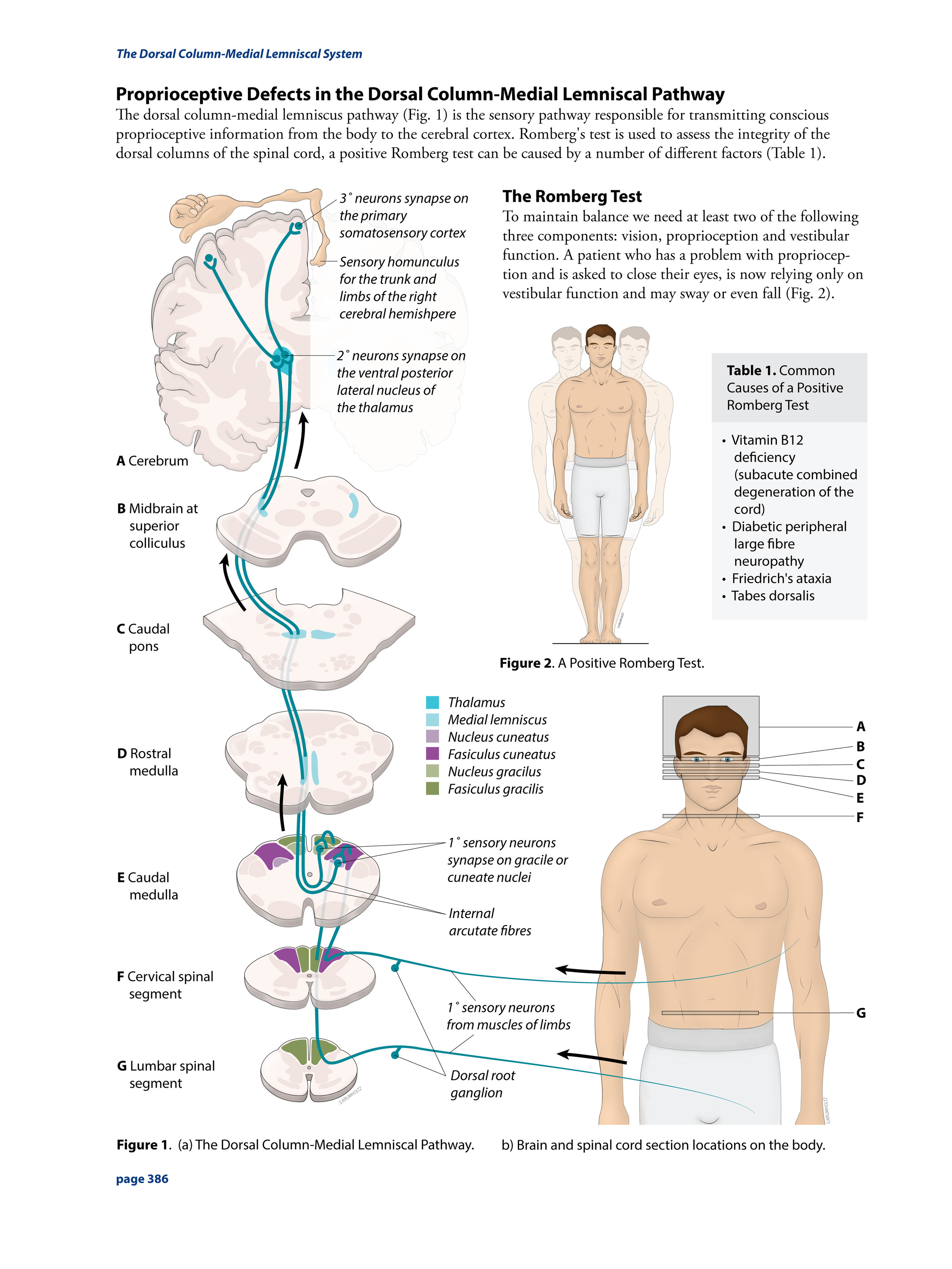 Proprioception Defects