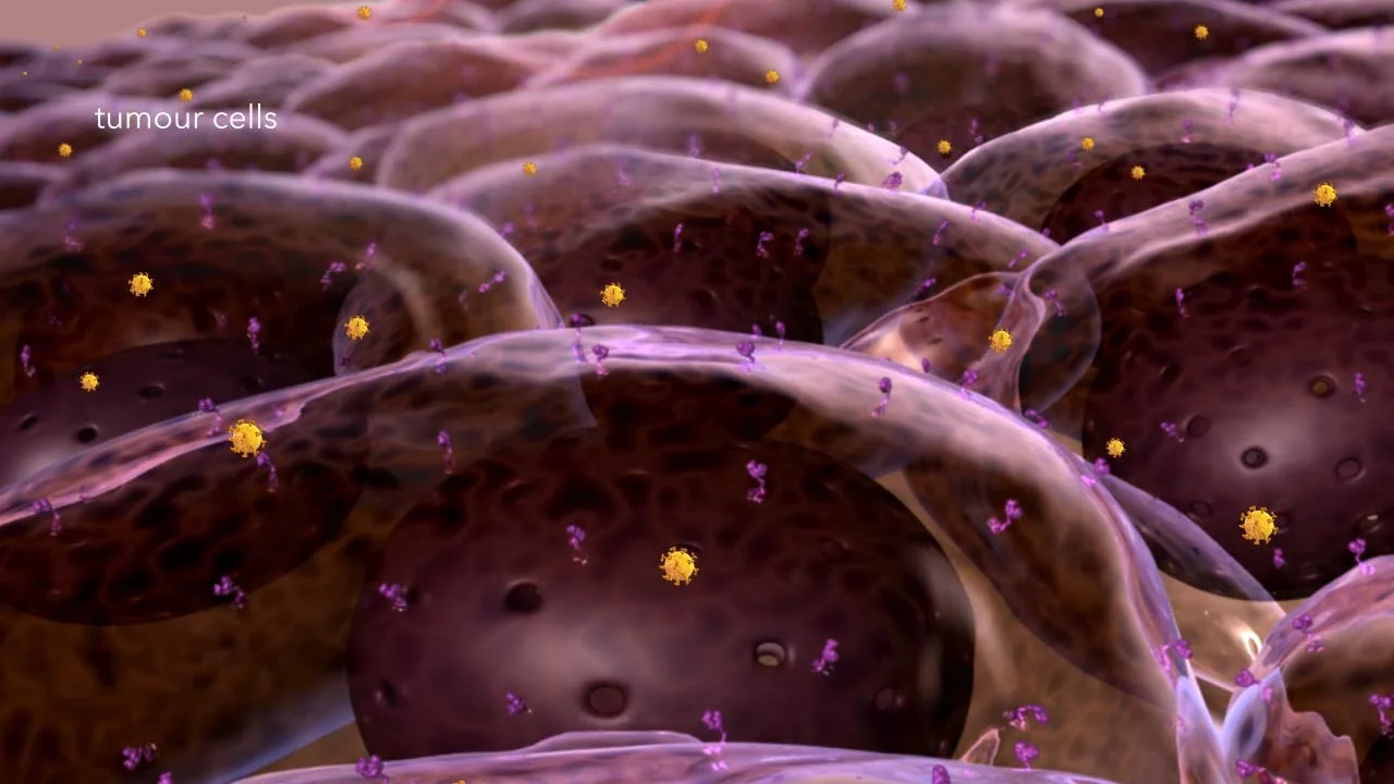 Brain Tumour Cell Field