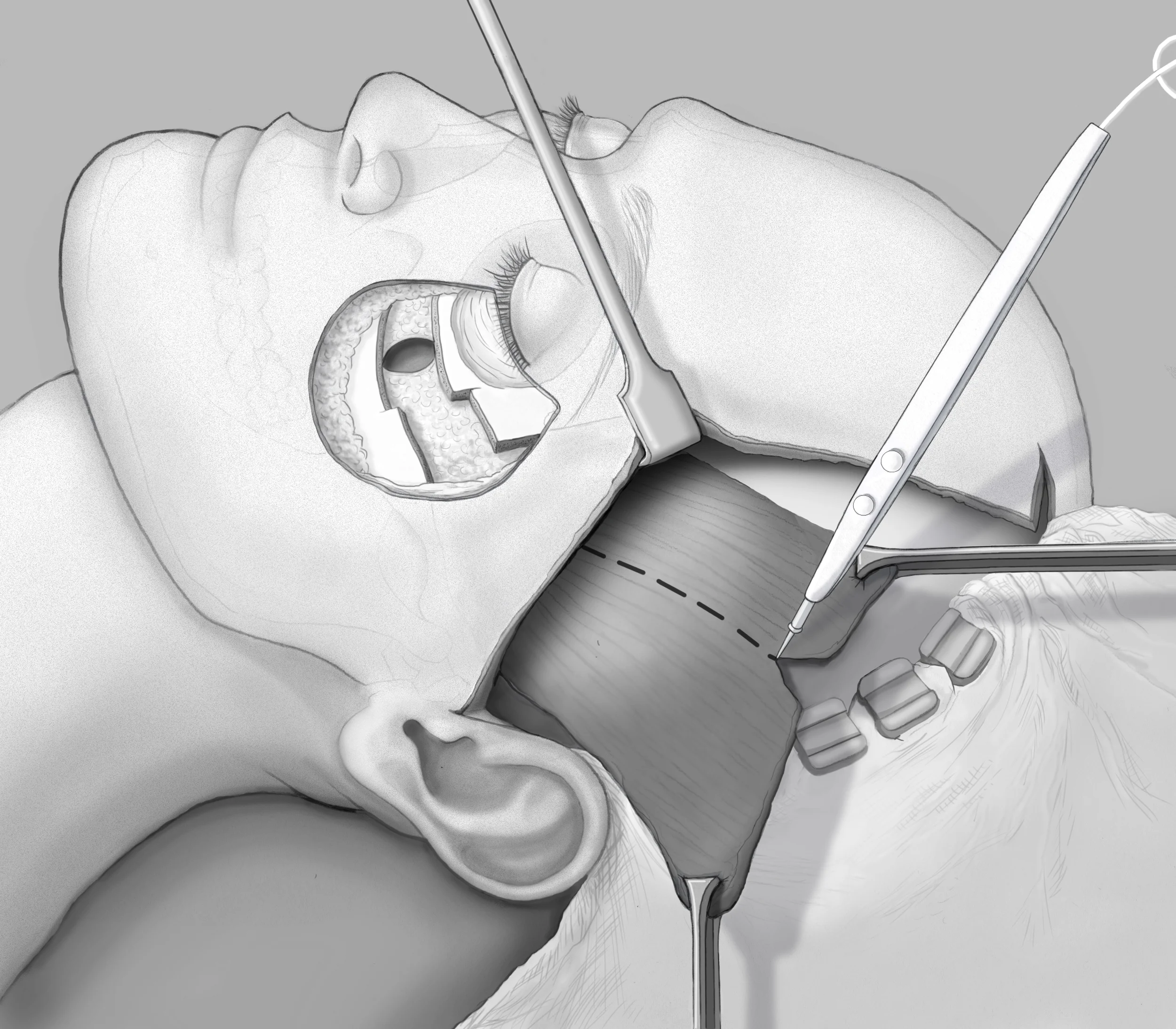 FIGURE2-RENDERED.jpg