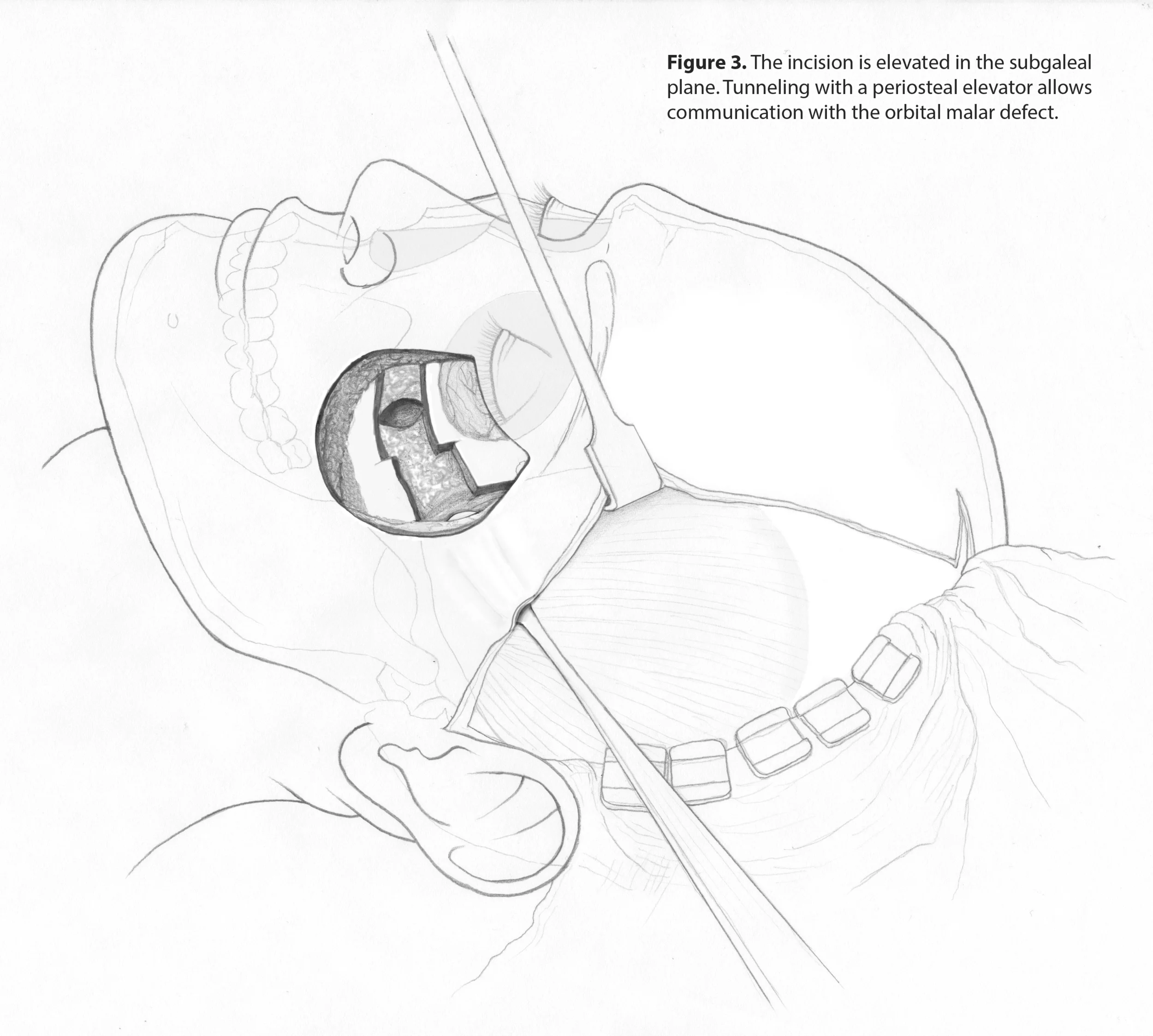 Figure 2.jpg