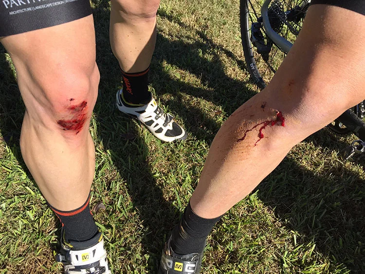 Fast, twisty course = blood, sweat and tears. Well, just blood.