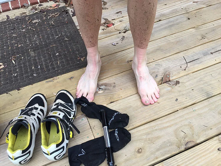 "Why are you feet and ankles so pale, bro?"