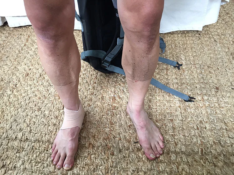 First CX race, injured ankle from running. Last year was muddy, this year was DUSTY.