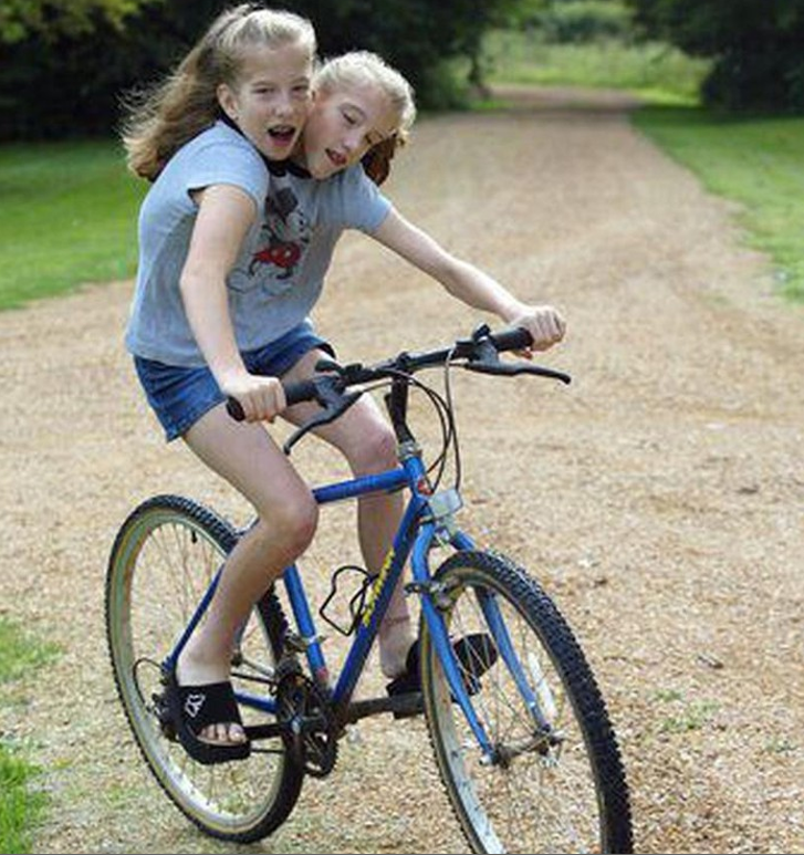 Thoạt nhìn Abigail và Brittany giống một người có hai đầu.