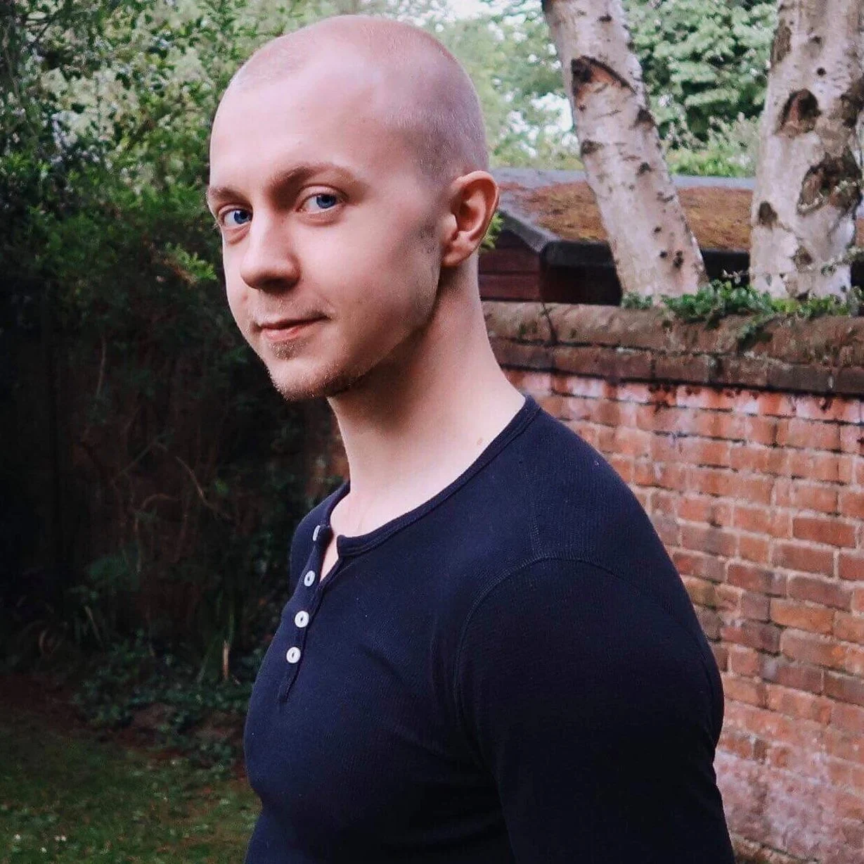 On male pattern baldness