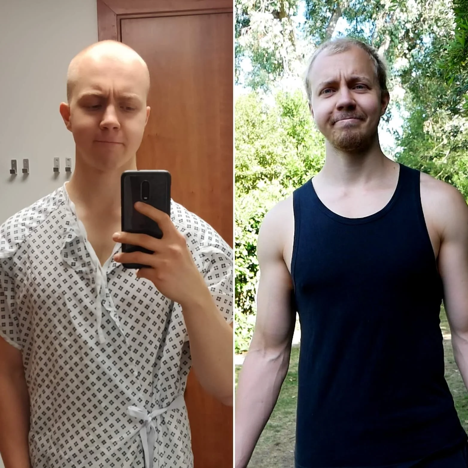 Jack is Back - Eating Disorder/Exercise Addiction Recovery