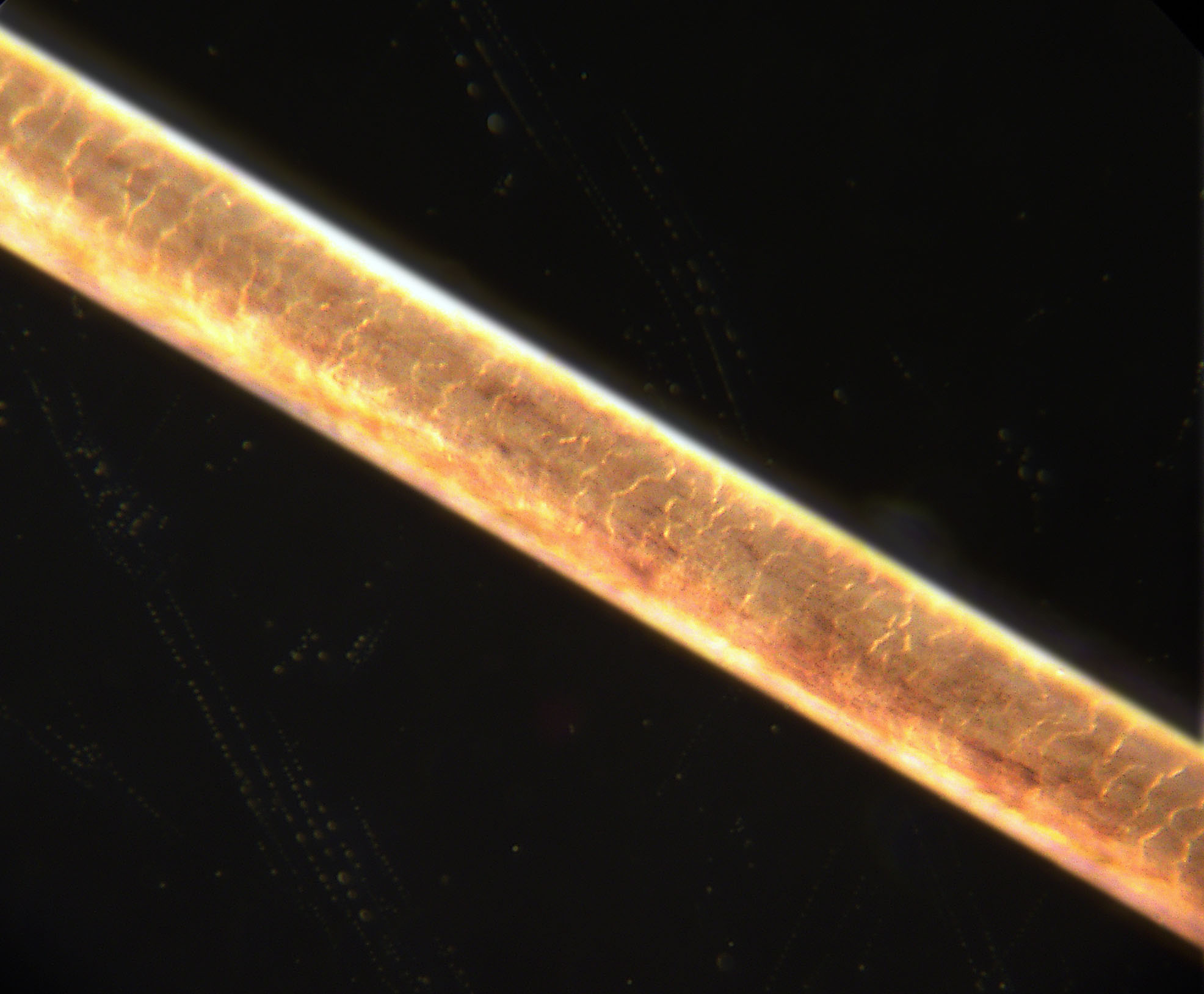 This is a human hair, you can see the overlapping cells of the cuticle layer that can open up and expose the inner part of the hair.