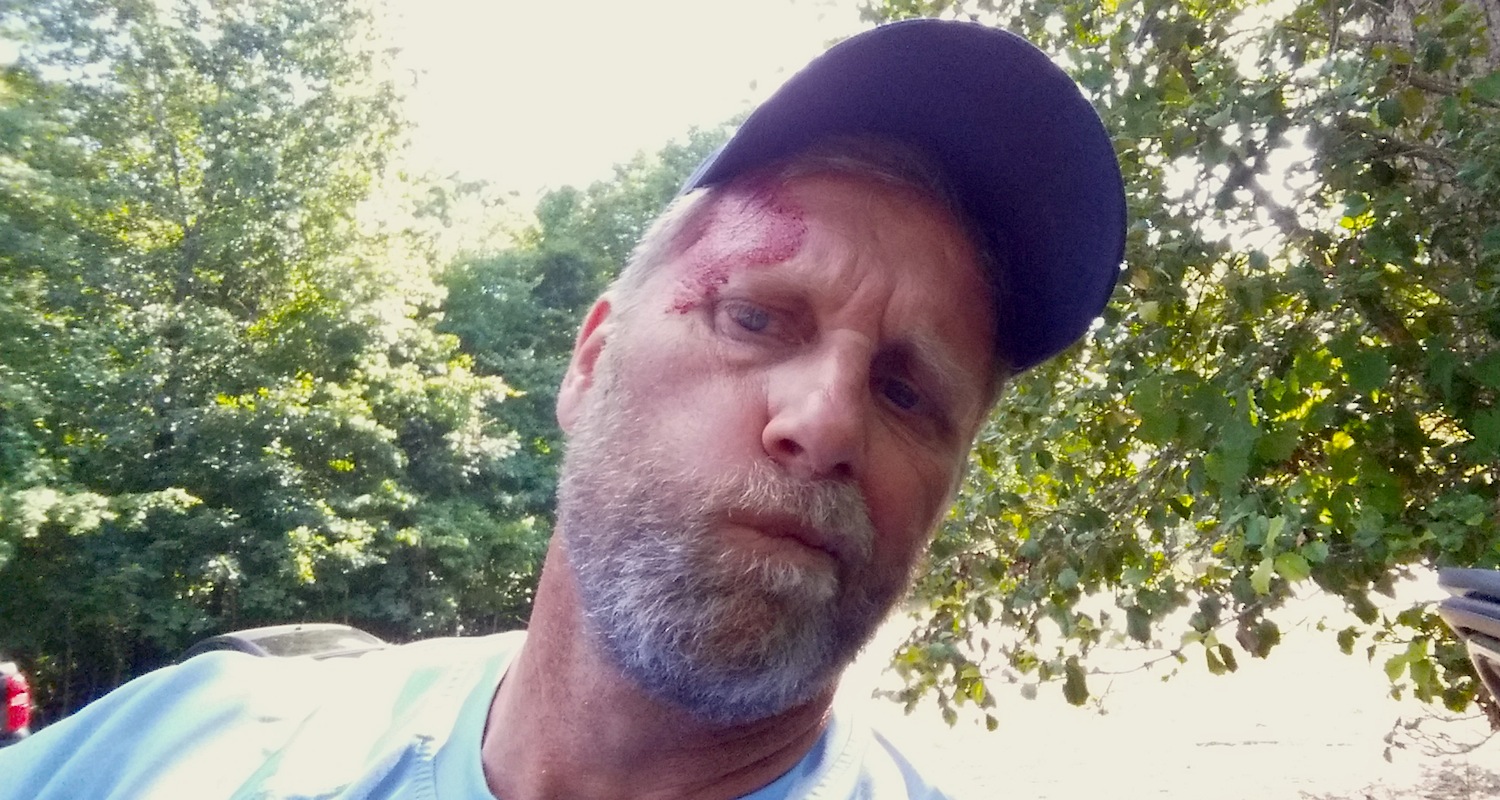 Yours truly, all concussed-like.