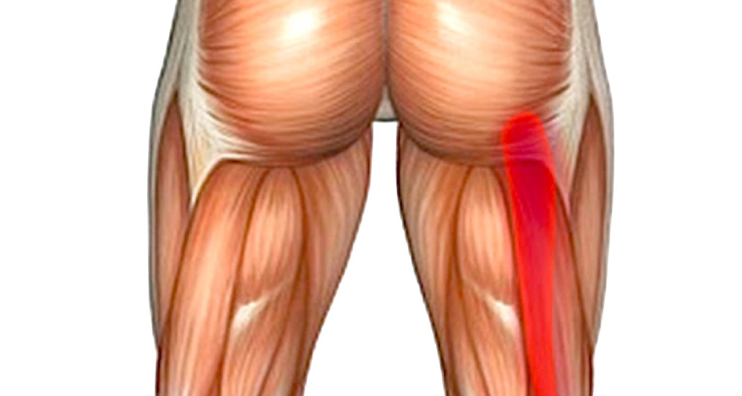 A hamstring injury is a real pain in the butt. Image from here.