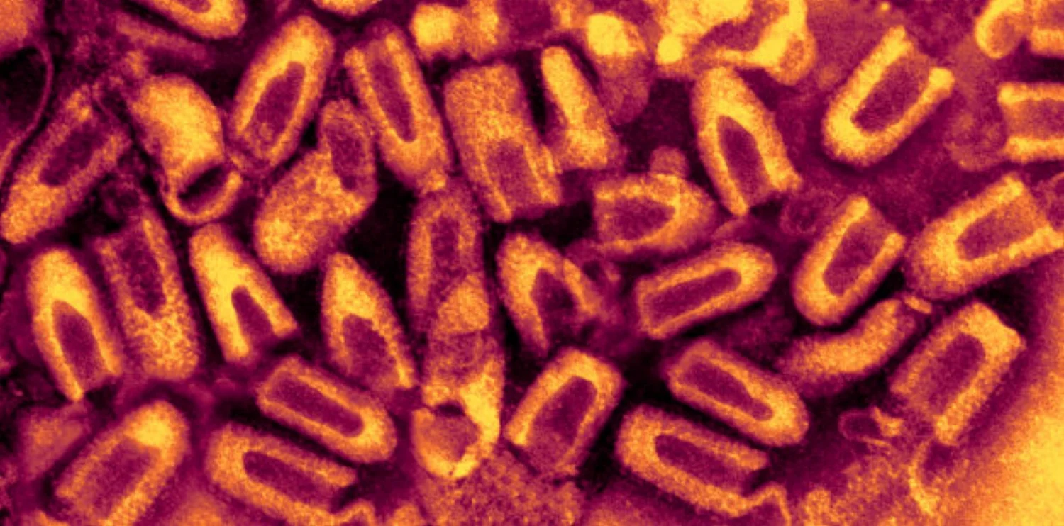 The rabies virus under a microscope. Image from here.