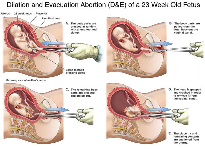 From National Right to Life Committee website