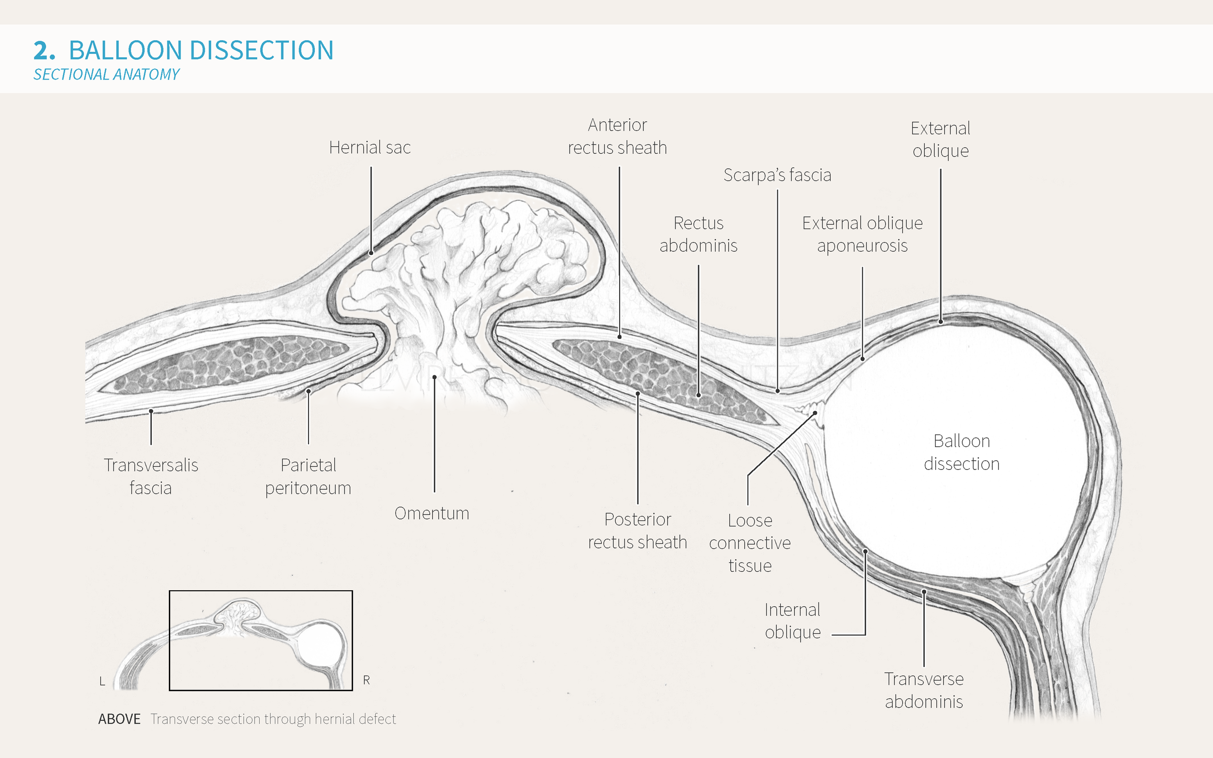 Elvire Thouvenot Components Separation Cuschieri Presentation_Page_16.png