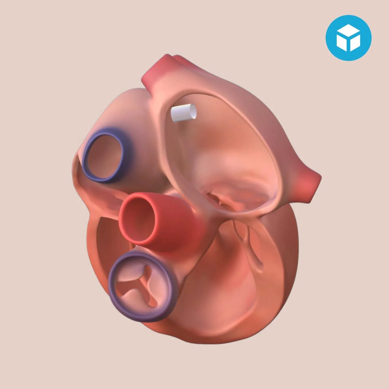 Percutaneous Mitral Valve Repair An interactive, animated 3D model and its complementary animation video illustrating the functioning of a new medical device. Coming soon
