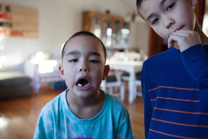 7/30 : the second tooth