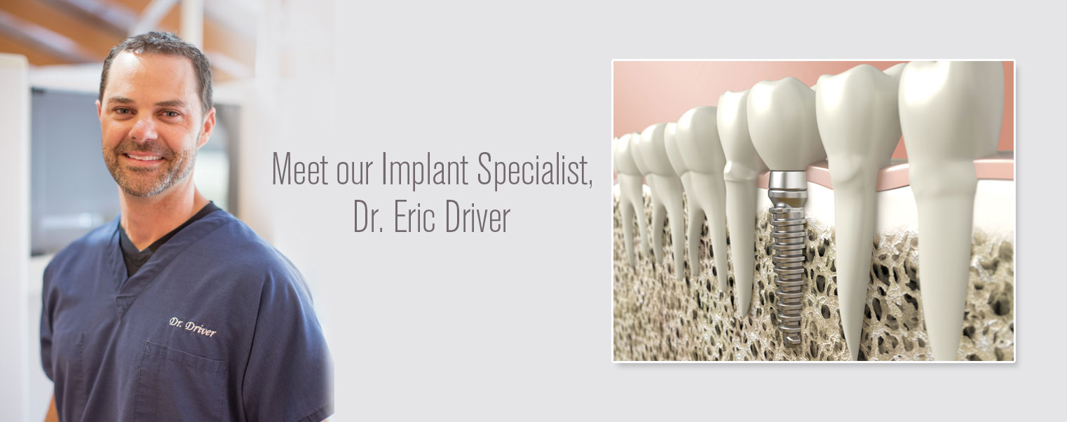 Dental-implant-specialist-san-diego-town-center-dentistry-dental