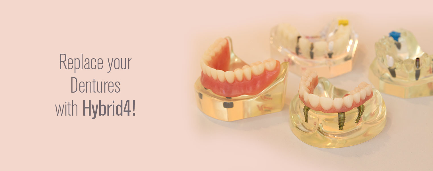 All-On-Four-San-Diego-Dentures-Town-Center-Dentistry