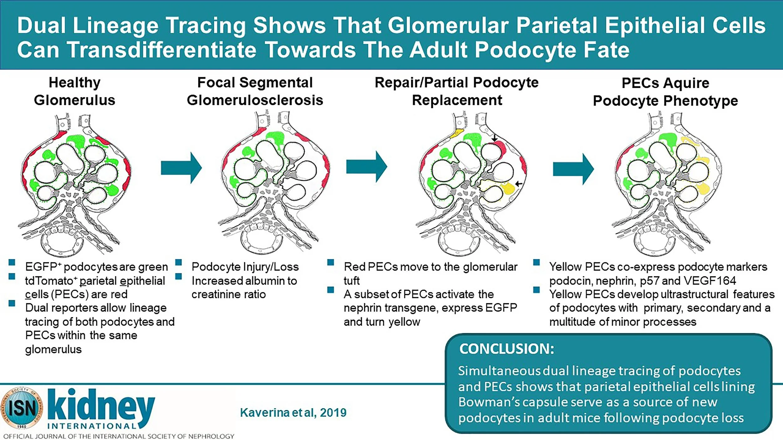 KI Visual Abstract KI-05-18-0613.jpg