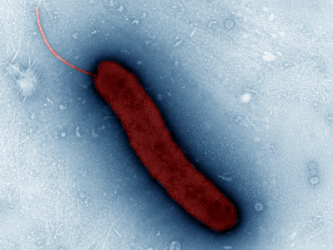 Vibrio metoecus , the closest known relative of Vibrio cholerae (transmission electron micrograph in false colour by Paul Kirchberger)