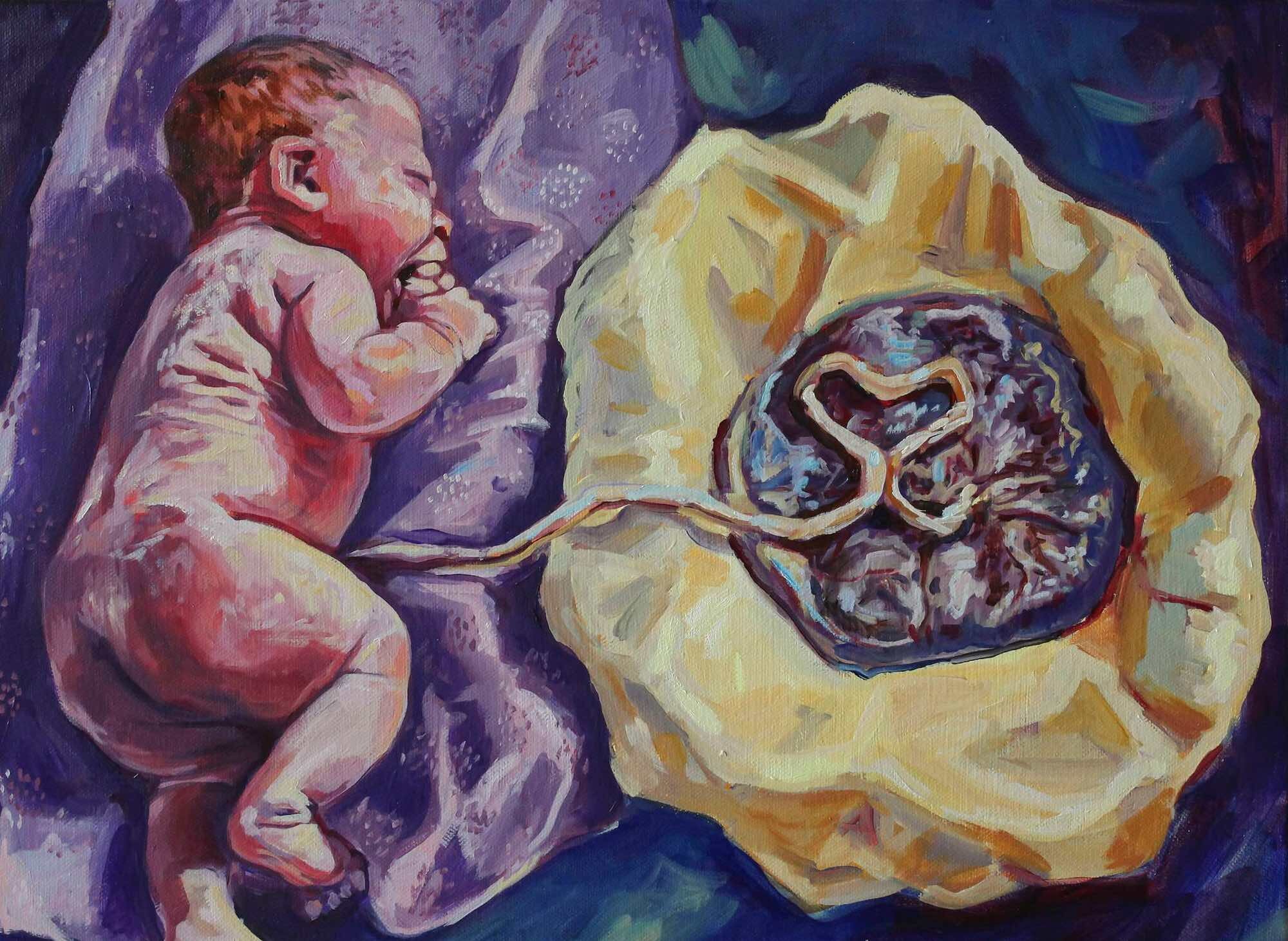 Placenta Encapsulation The Essential Guide