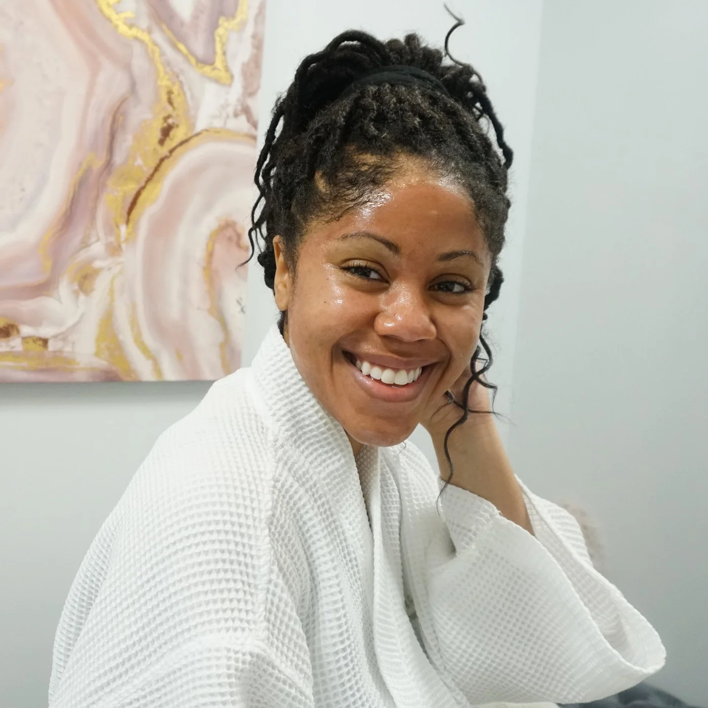 Post Treatment Picture: This image was taken immediately after my microneedling. I wanted to show you what my face looked like post microneedling with my plasma serum on my face.