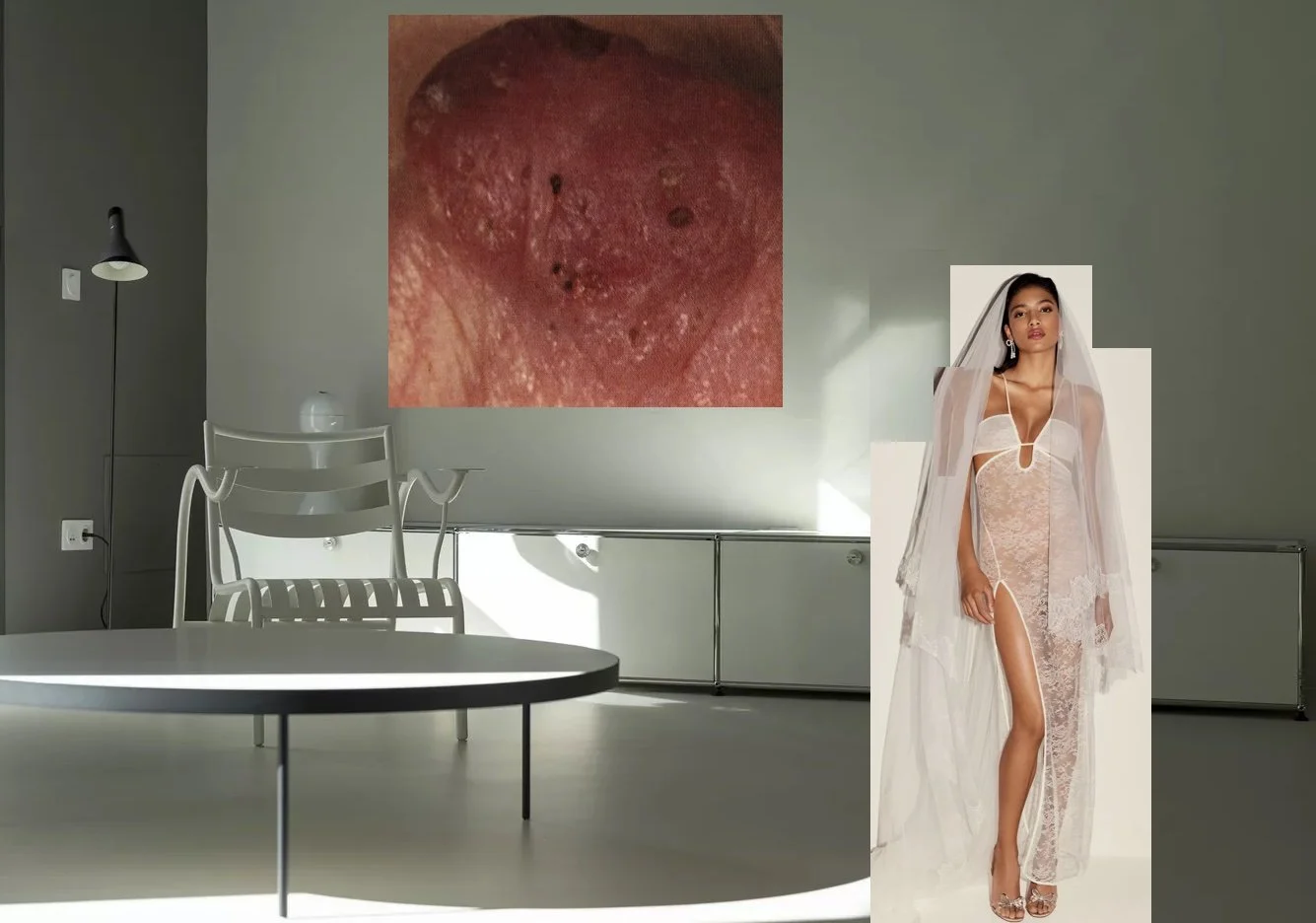 Billionaires Disease